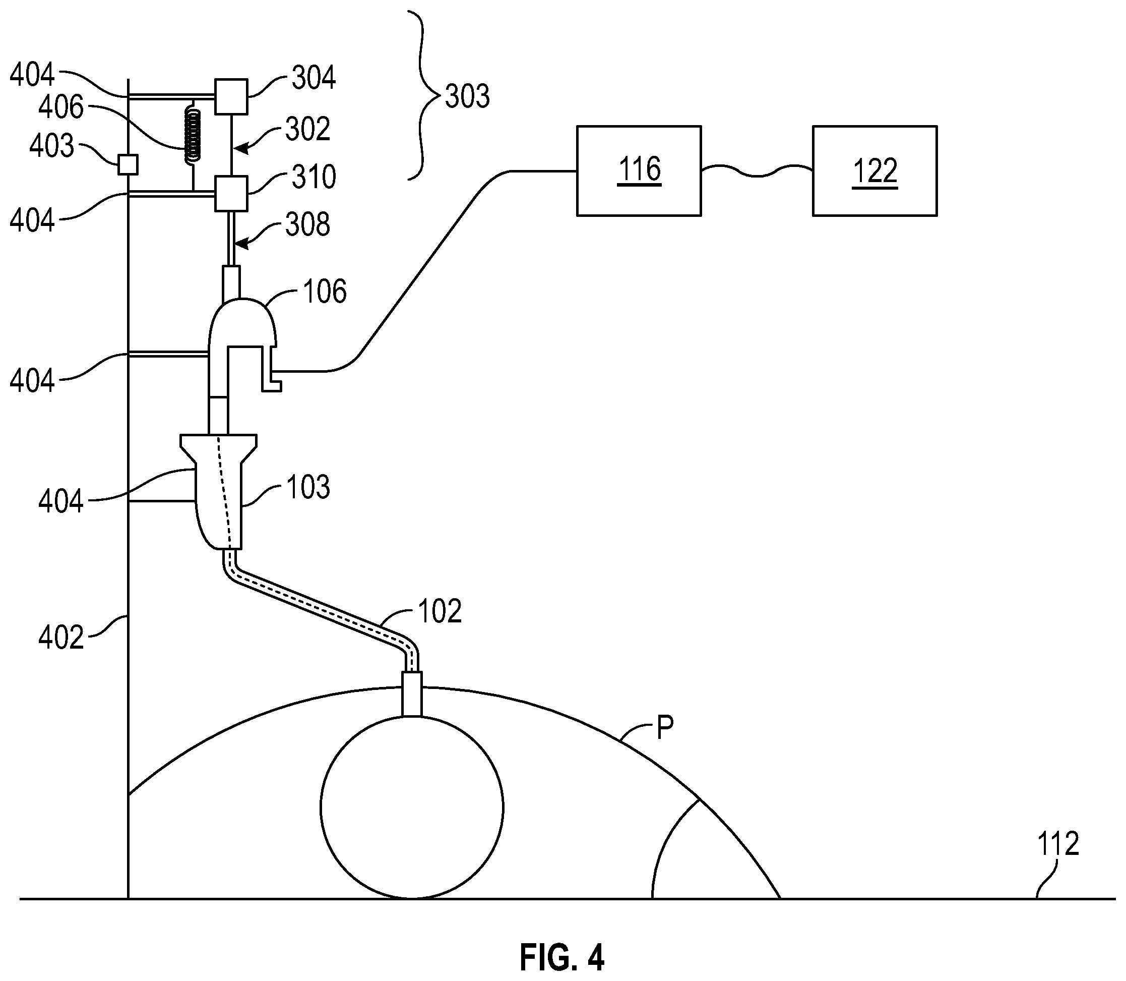 Patent US12599402 Figure 4 – Deflectable pulmonary access tool