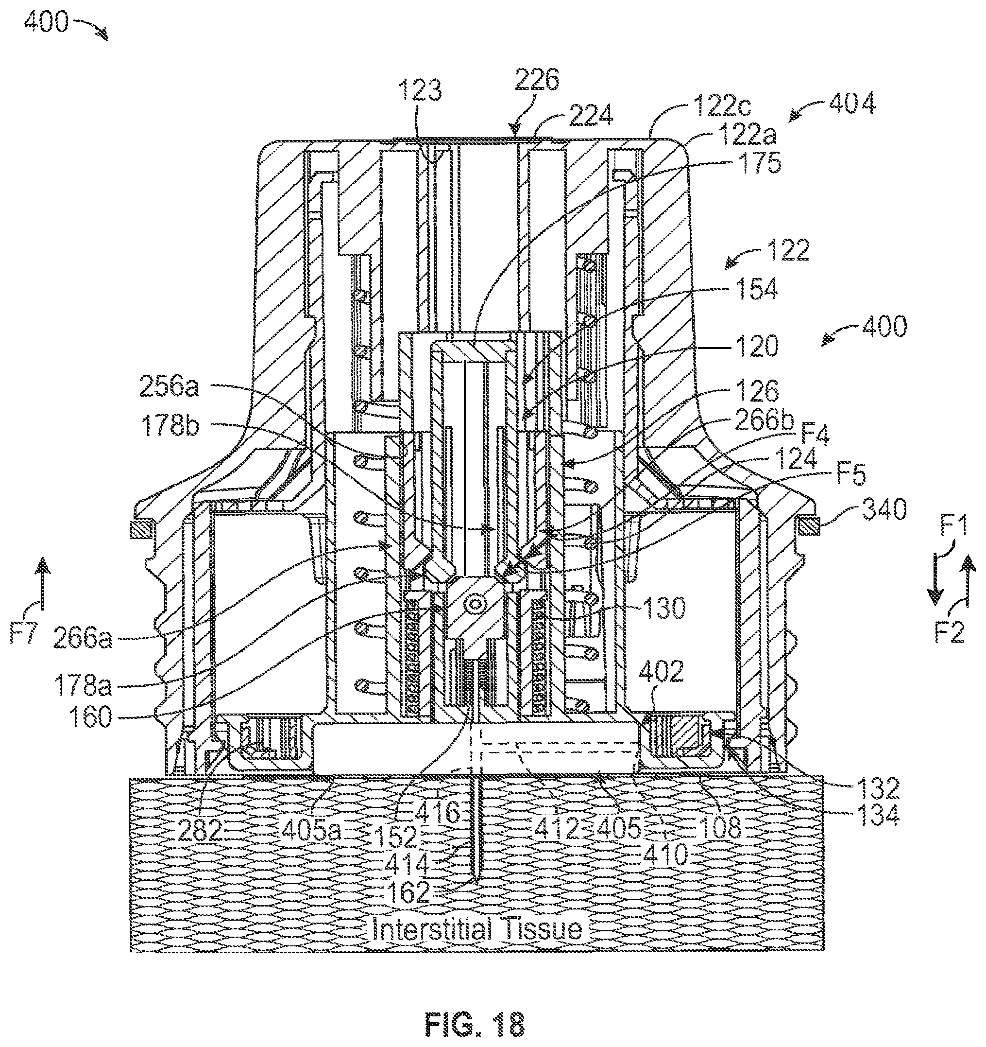 Patent US12599404 Figure 14 – Disposable medical device introduction system