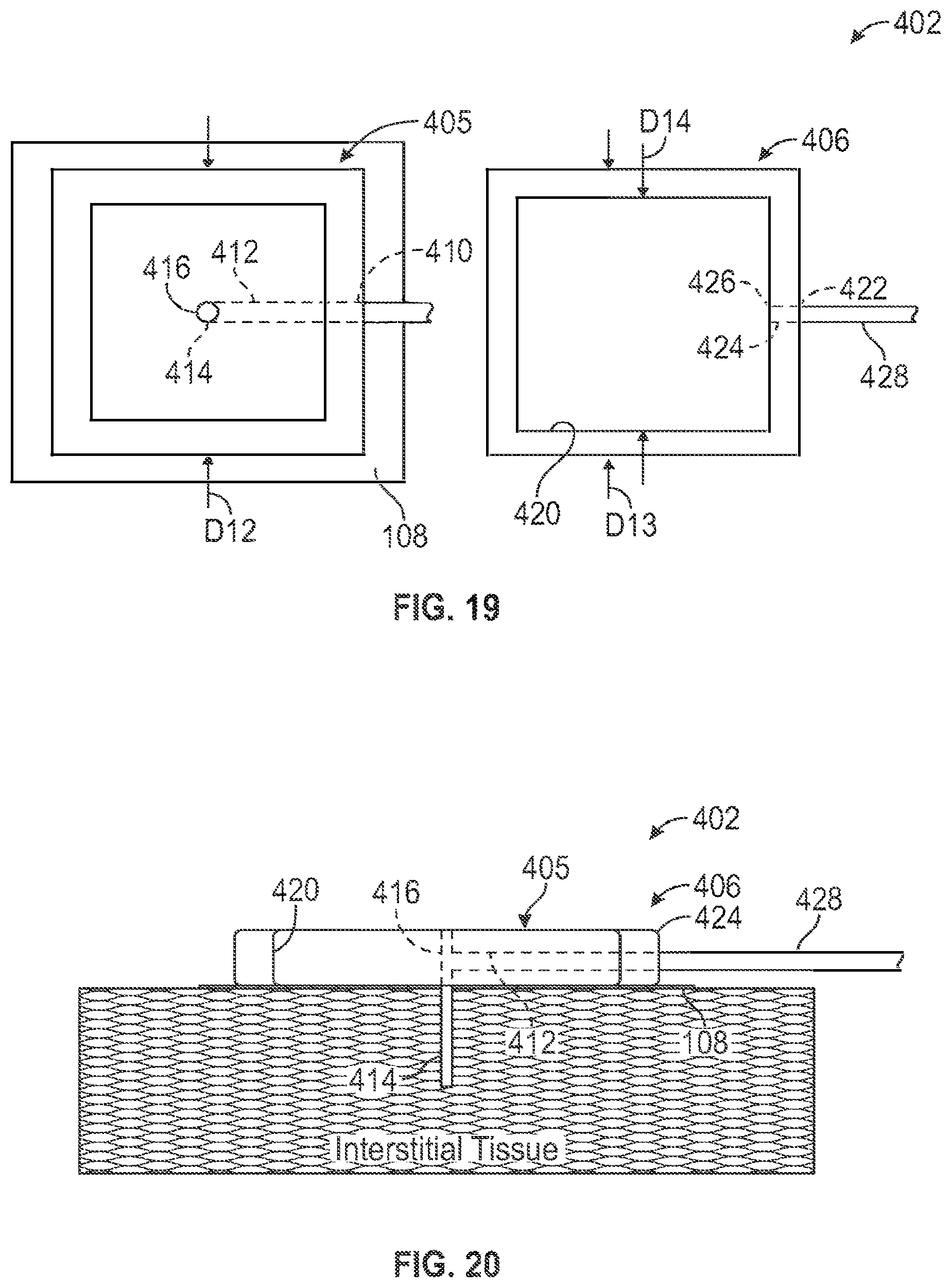 Patent US12599404 Figure 15 – Disposable medical device introduction system