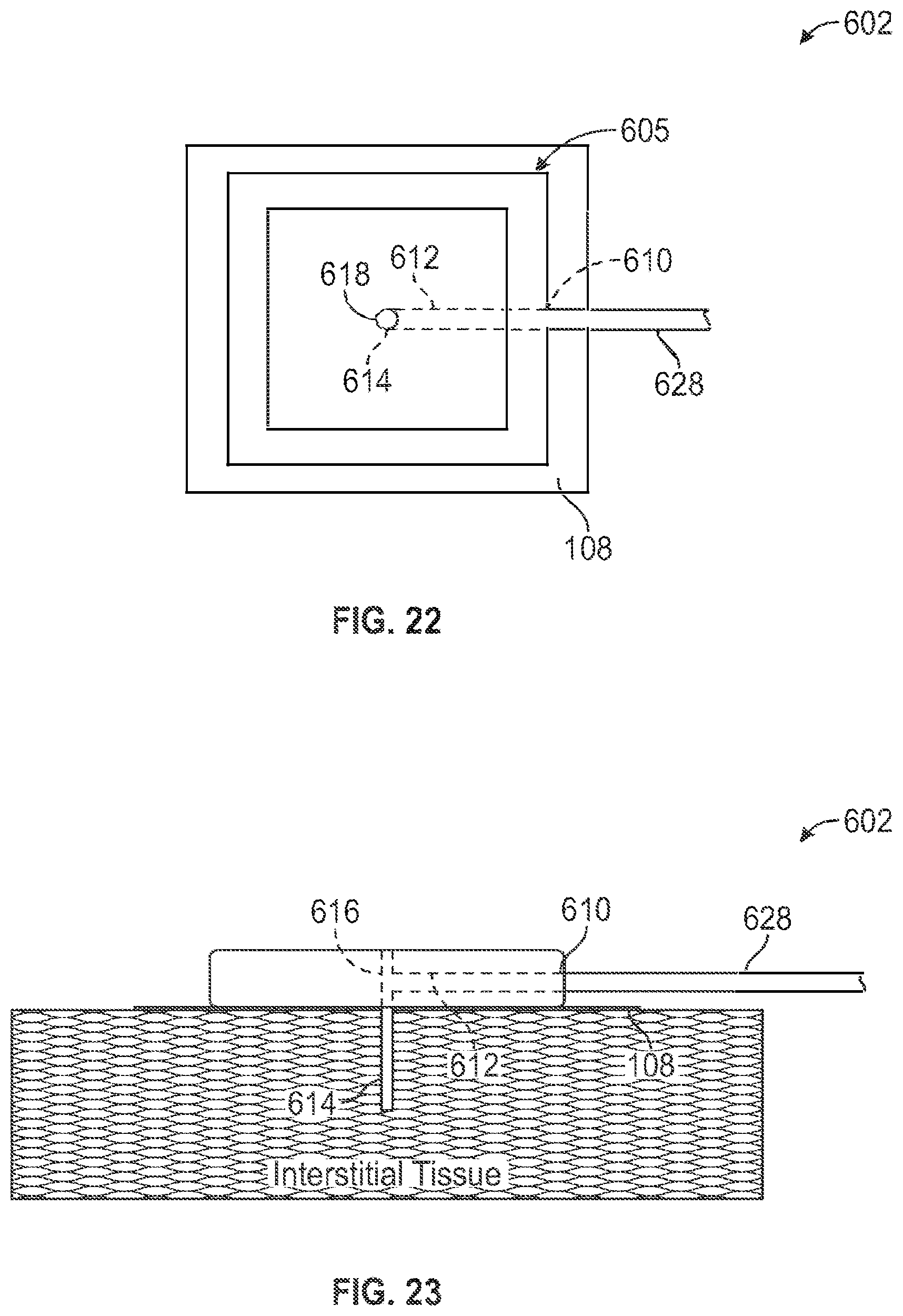 Patent US12599404 Figure 17 – Disposable medical device introduction system