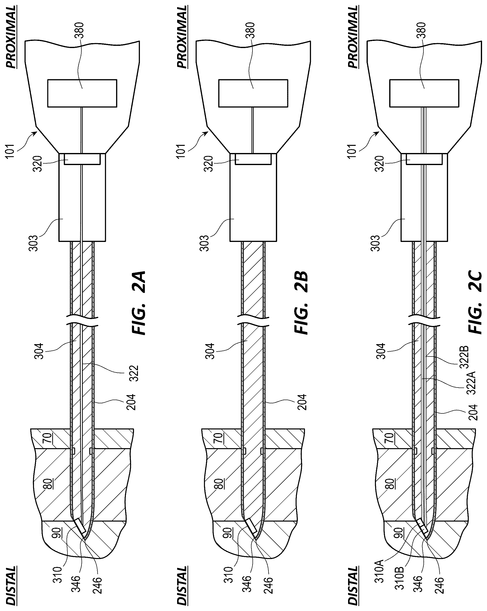 Patent US12599405 Figure 4 – Intraosseous device including a sensing obturator