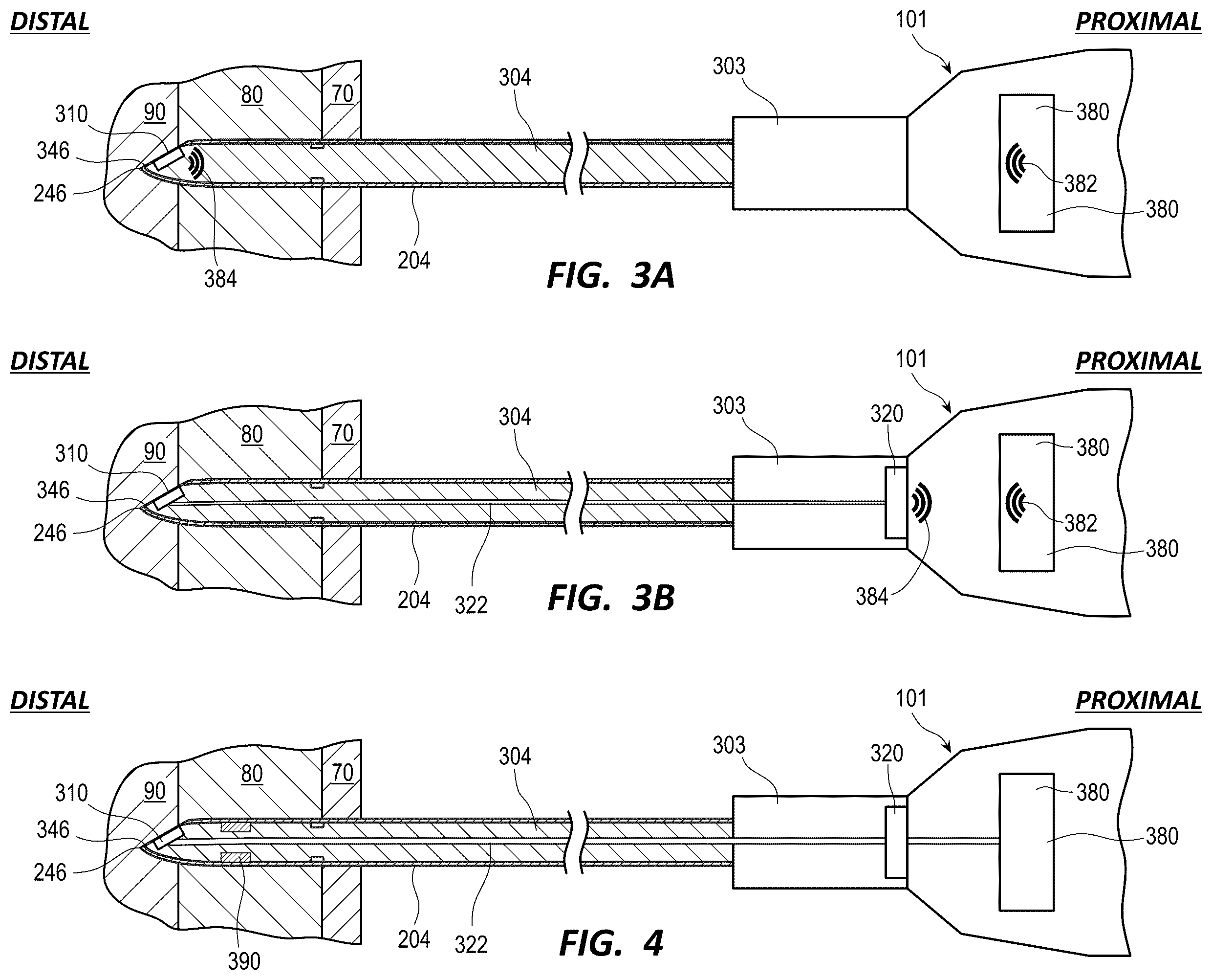 Patent US12599405 Figure 5 – Intraosseous device including a sensing obturator