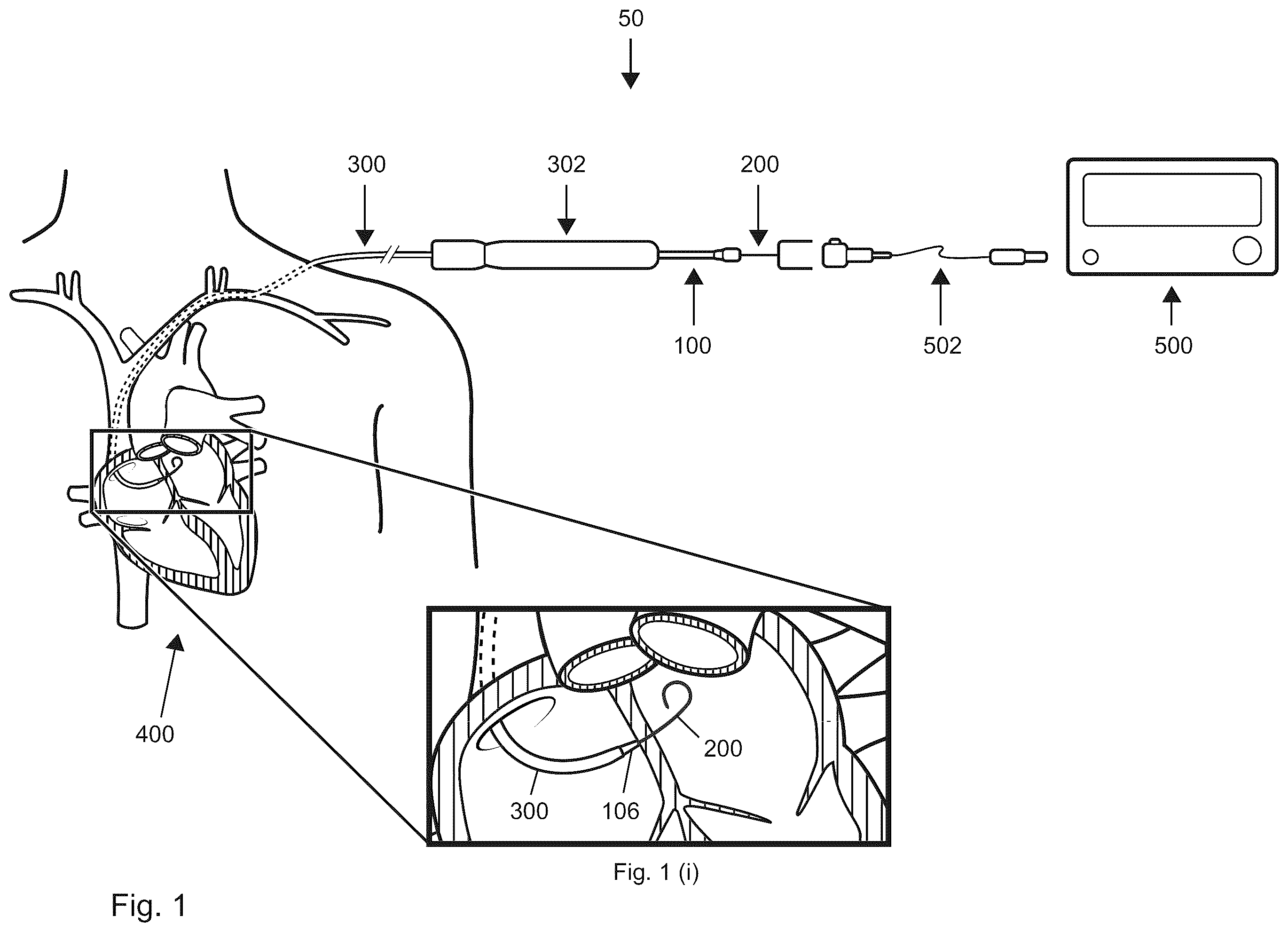 Patent US12599406 Figure 1 – Methods and devices for puncturing tissue
