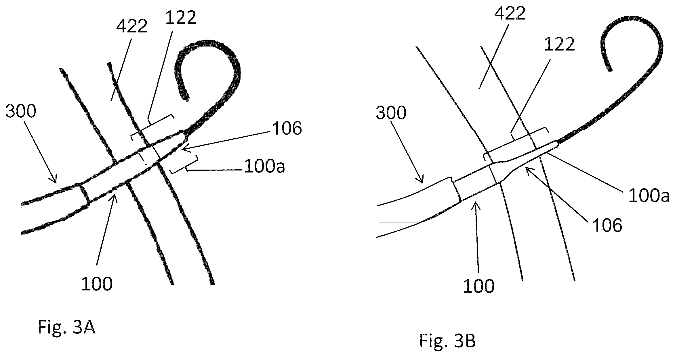 Patent US12599406 Figure 7 – Methods and devices for puncturing tissue