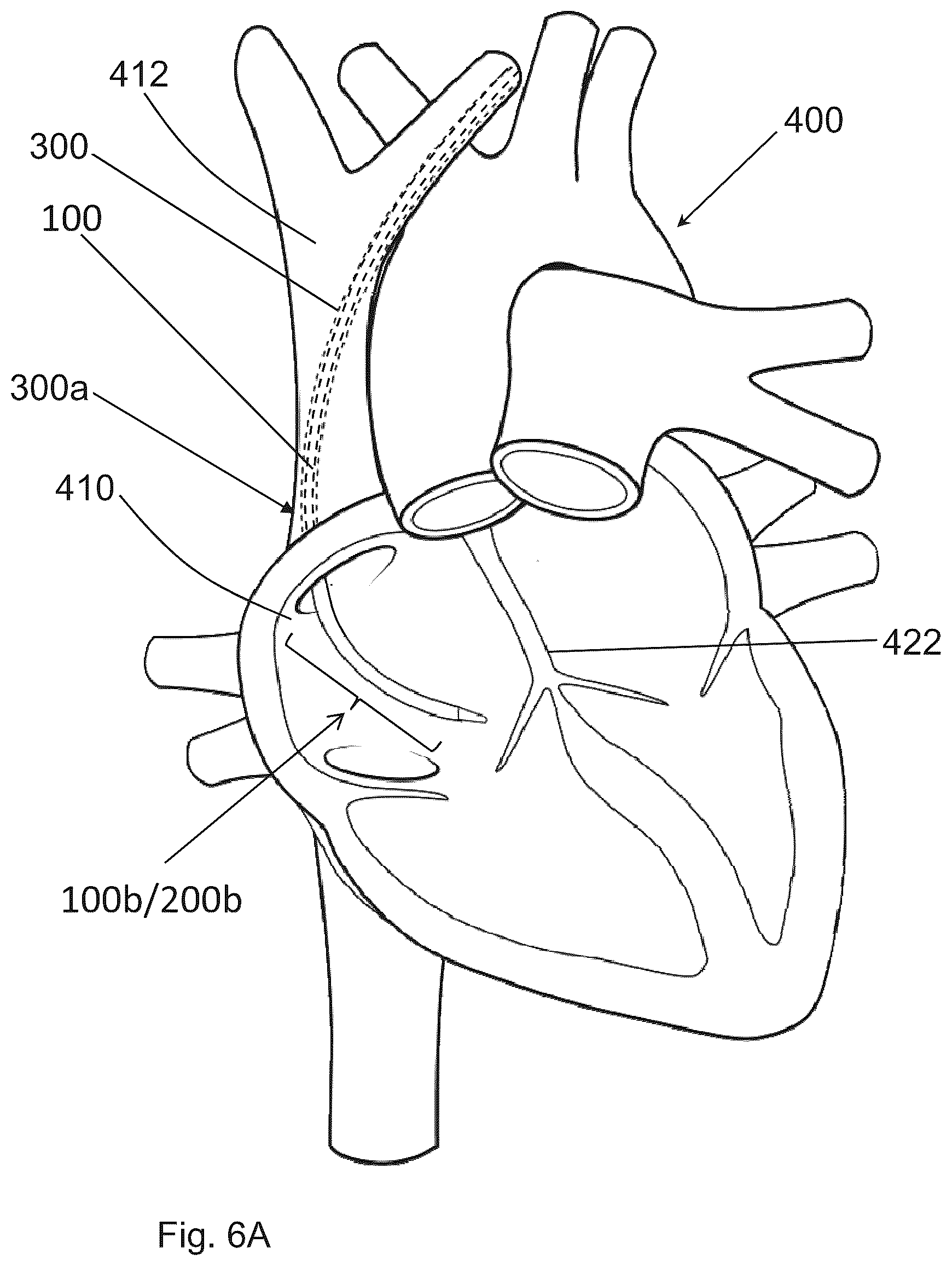 Patent US12599406 Figure 15 – Methods and devices for puncturing tissue