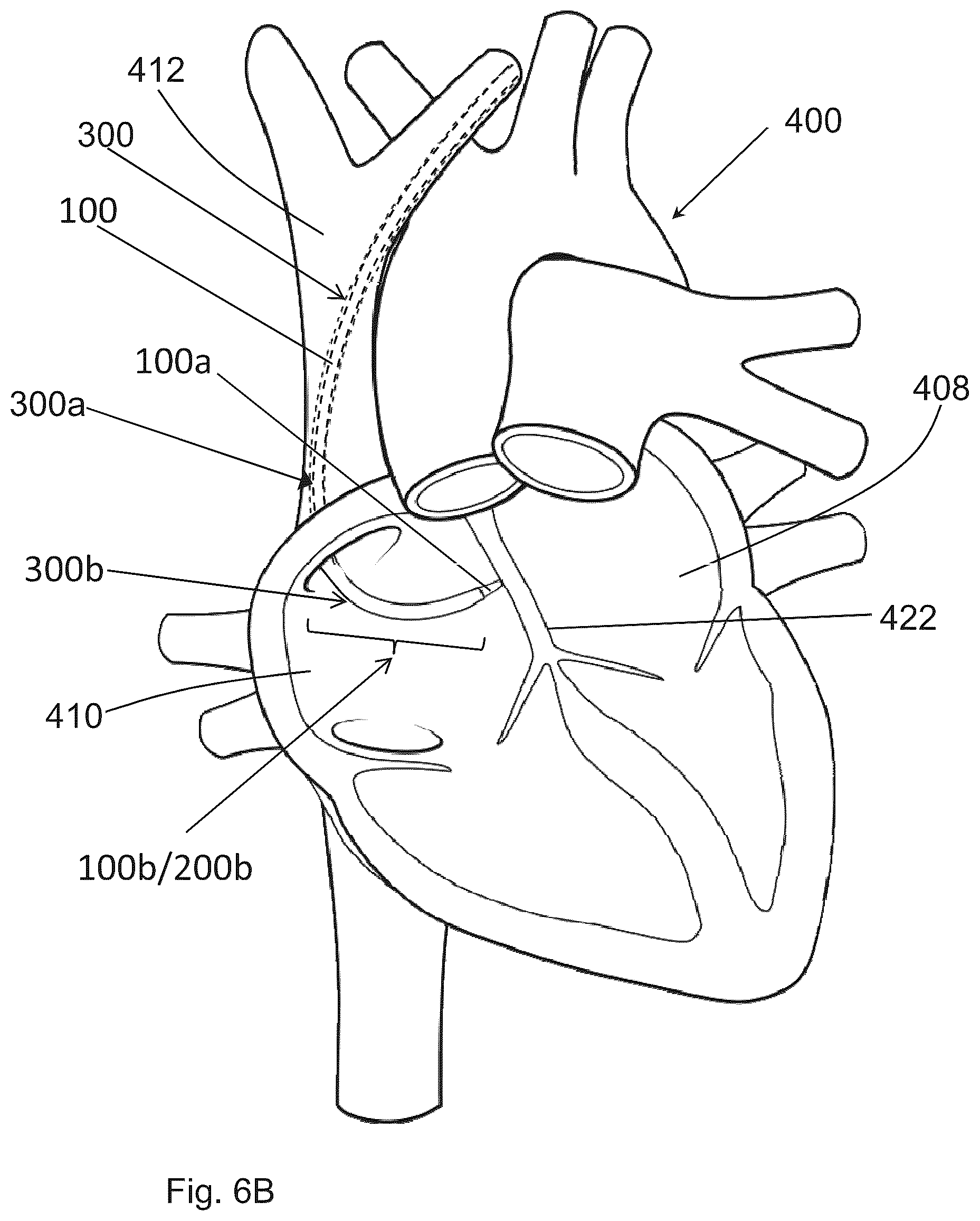 Patent US12599406 Figure 16 – Methods and devices for puncturing tissue