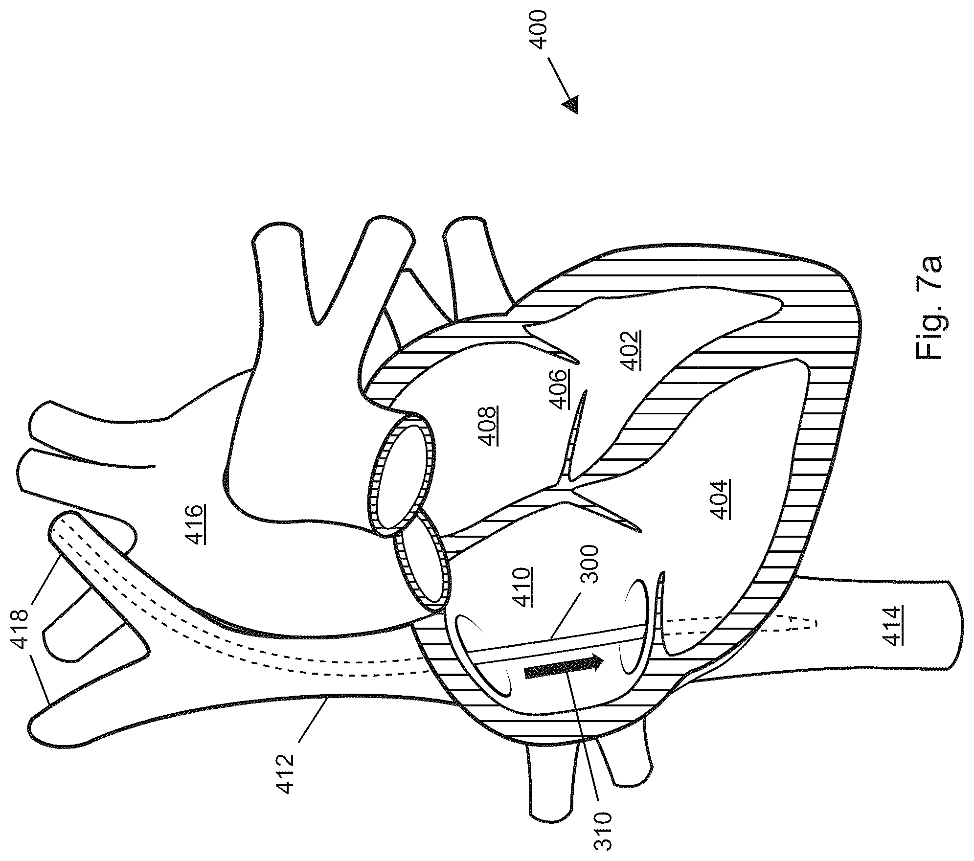 Patent US12599406 Figure 19 – Methods and devices for puncturing tissue