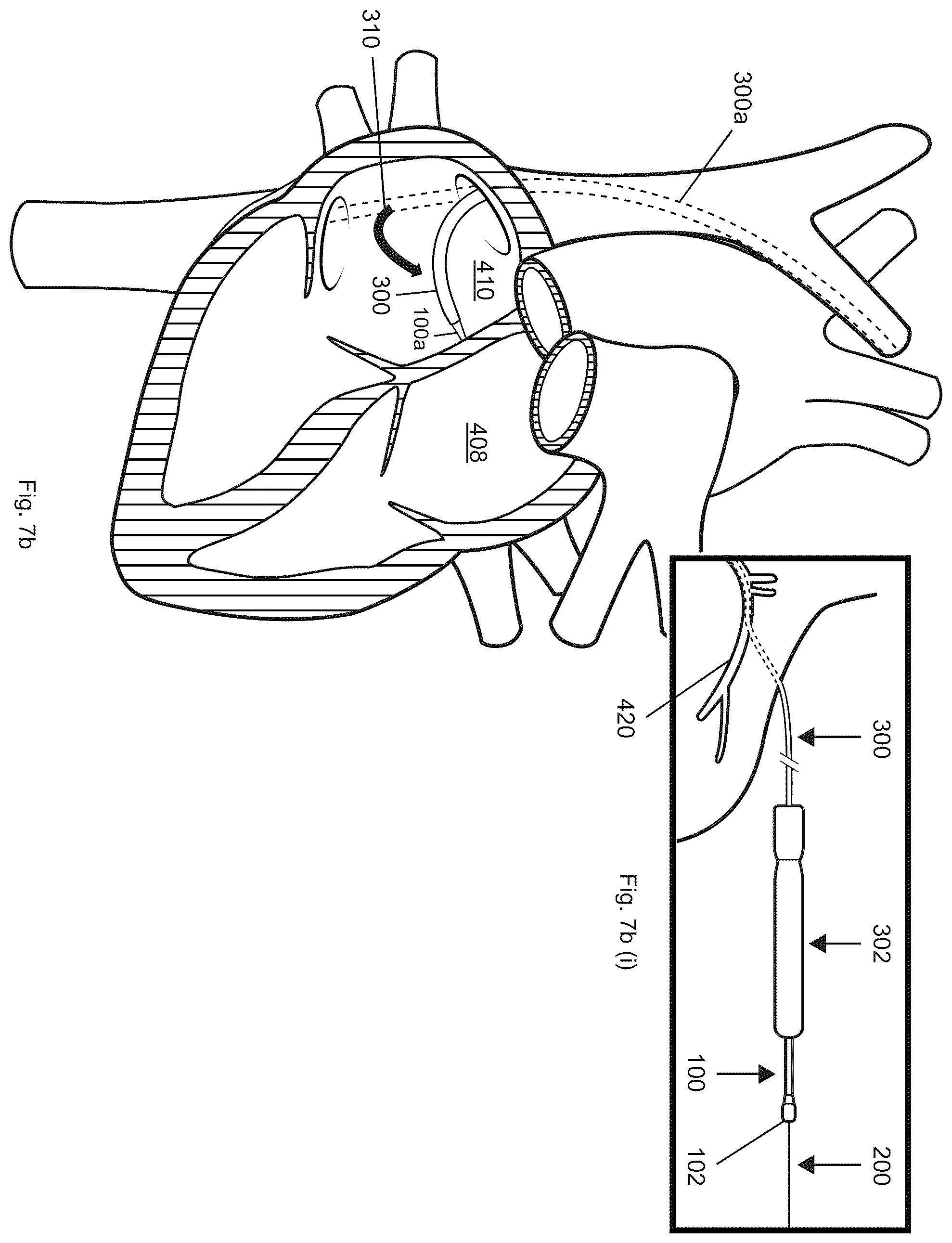 Patent US12599406 Figure 20 – Methods and devices for puncturing tissue