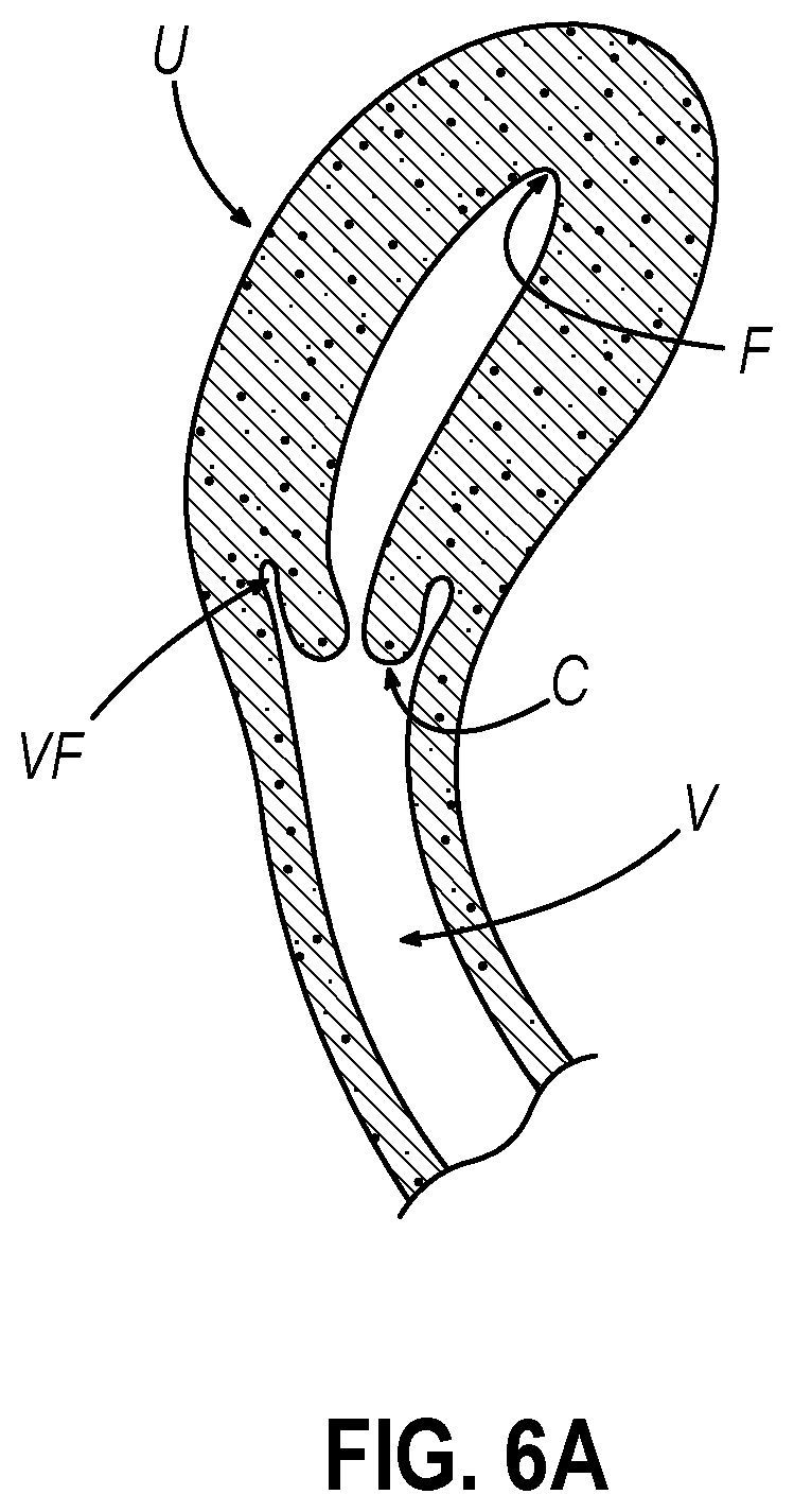 Patent US12599407 Figure 4 – System and method to measure uterine wall thickness