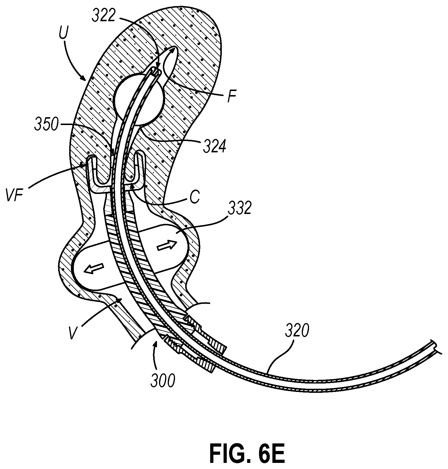 Patent US12599407 Figure 8 – System and method to measure uterine wall thickness