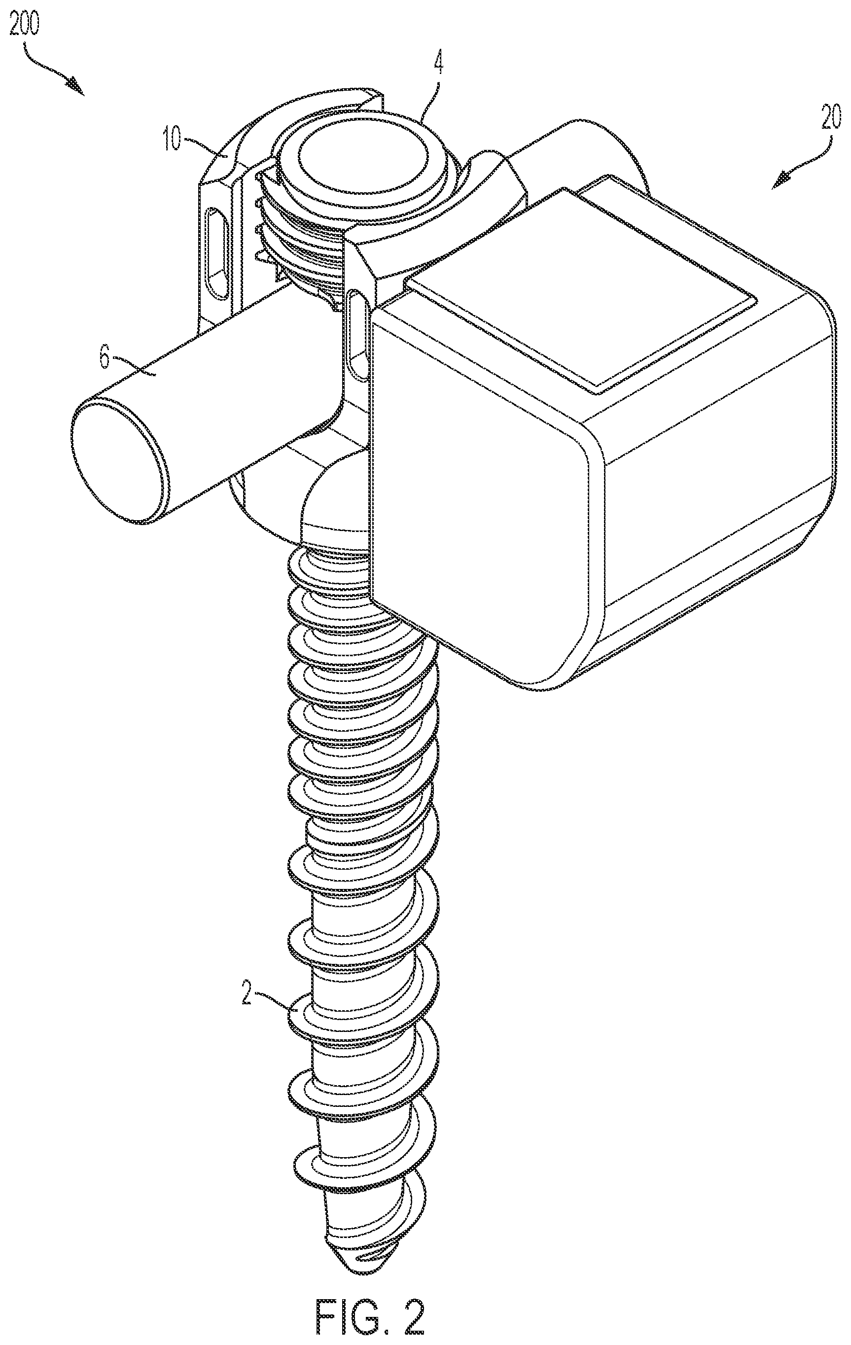 Patent US12599412 Figure 2 – Intra-operative options for smart implants