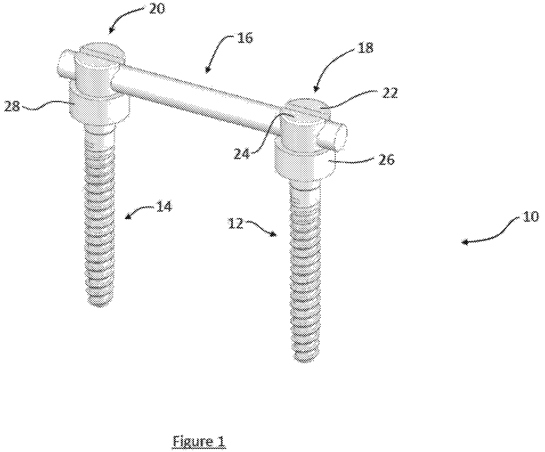 Patent US12599413 Figure 1 – Composite material spinal implant