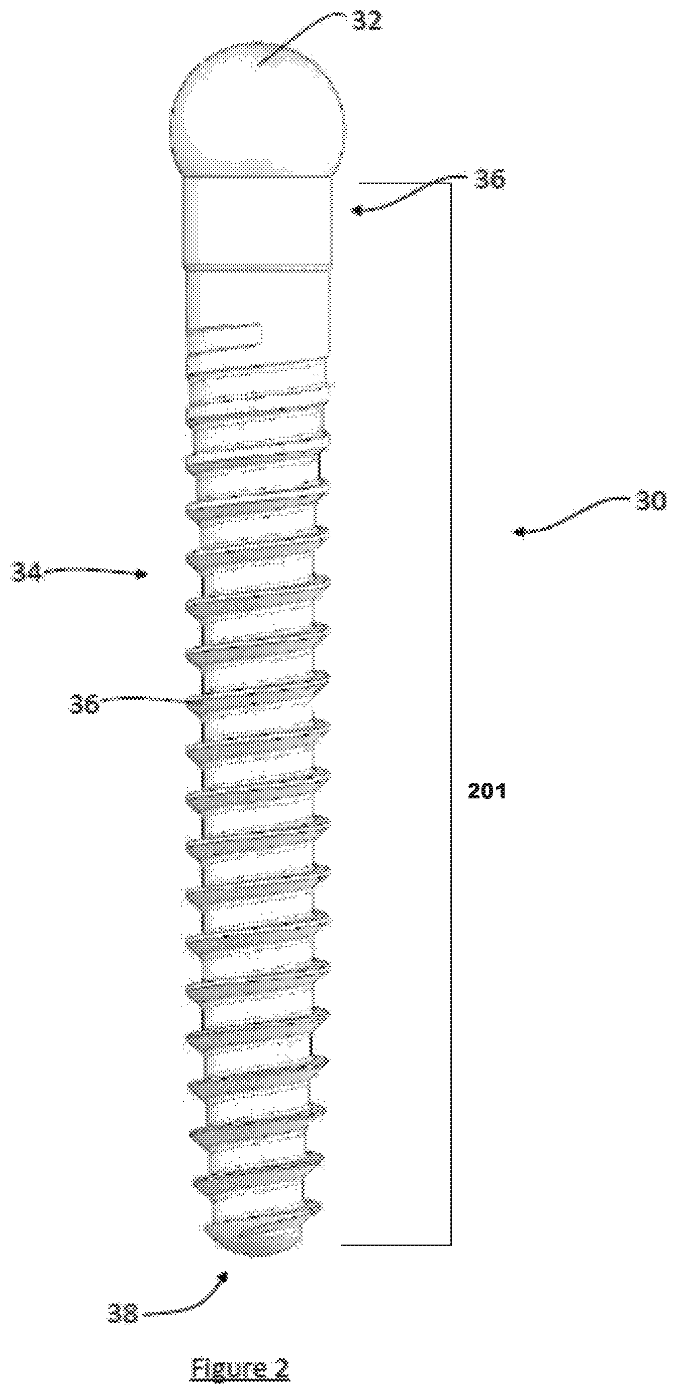 Patent US12599413 Figure 2 – Composite material spinal implant