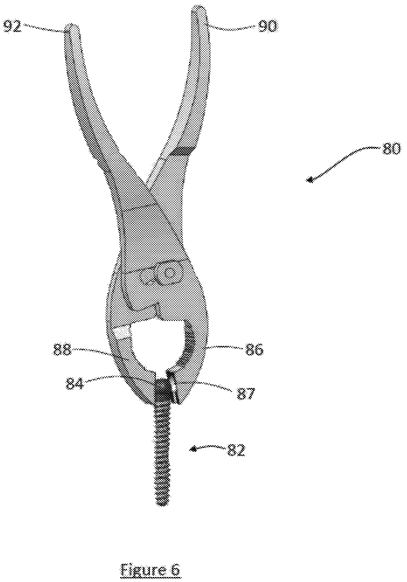 Patent US12599413 Figure 6 – Composite material spinal implant