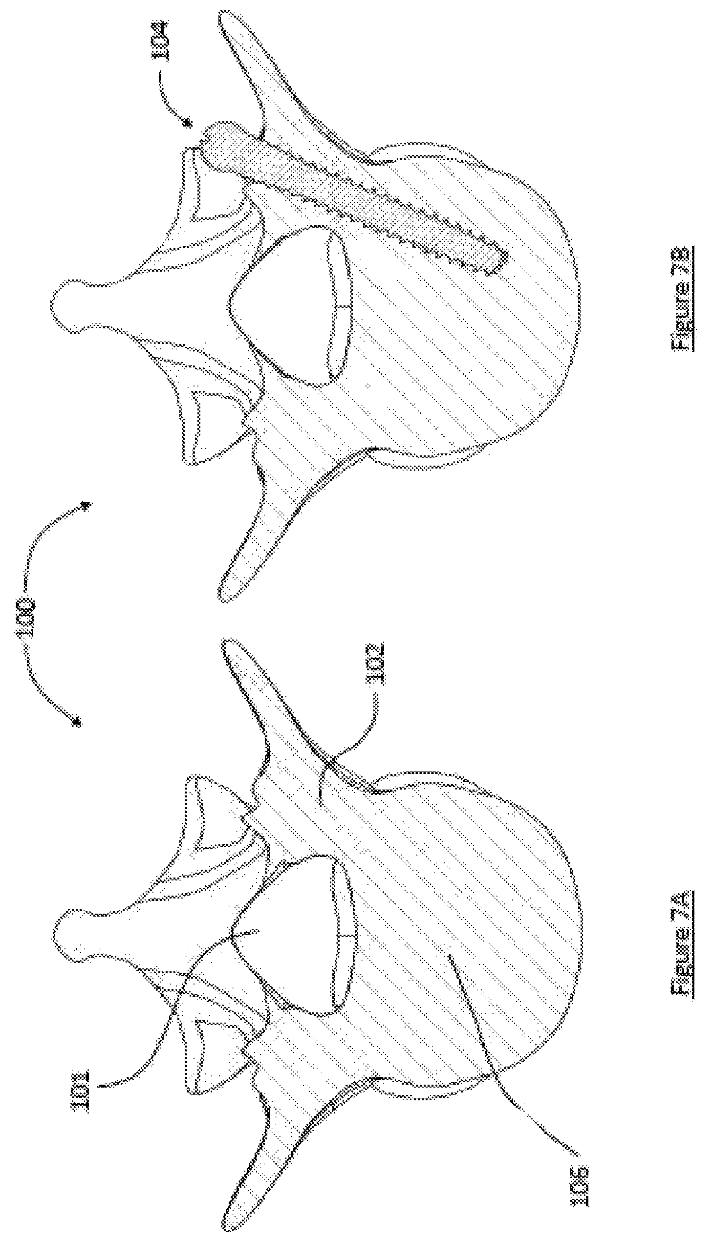 Patent US12599413 Figure 7 – Composite material spinal implant