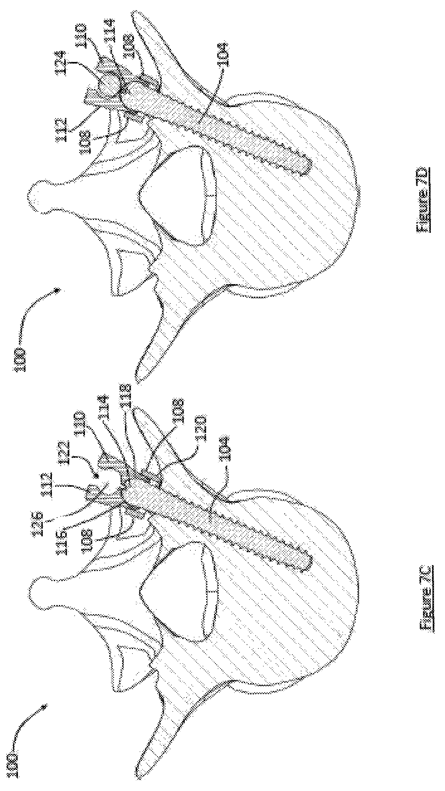 Patent US12599413 Figure 8 – Composite material spinal implant