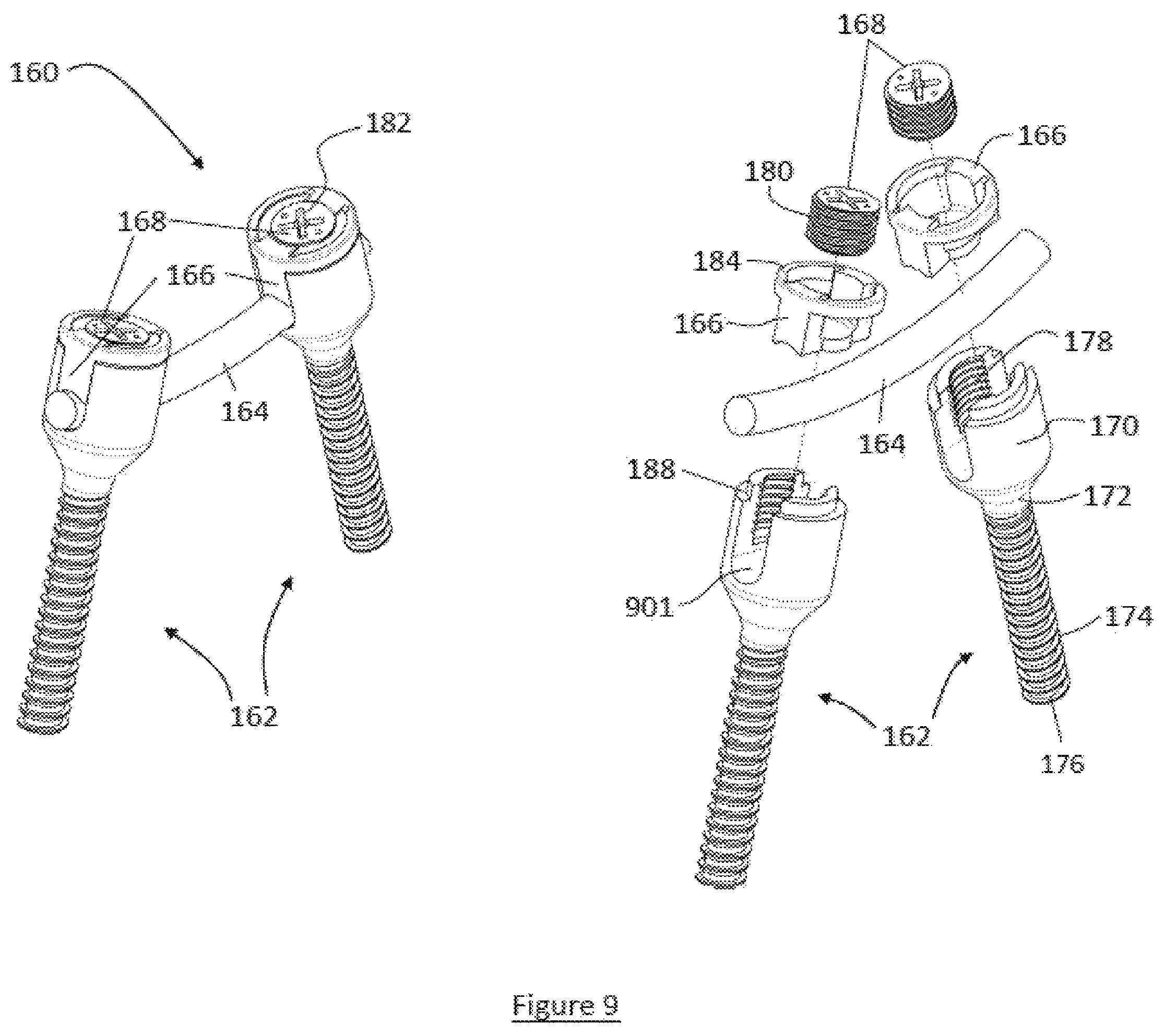 Patent US12599413 Figure 12 – Composite material spinal implant