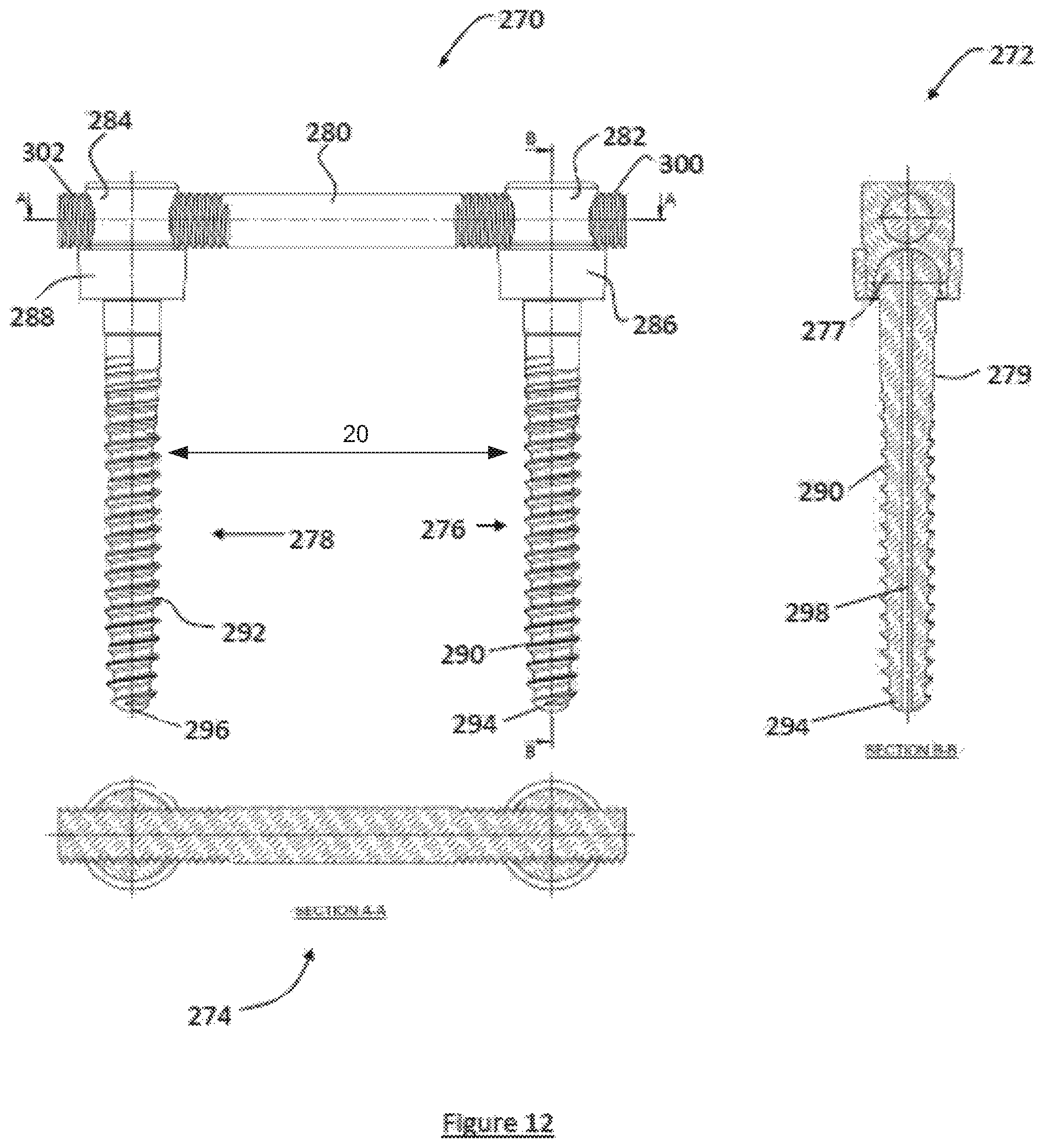 Patent US12599413 Figure 15 – Composite material spinal implant