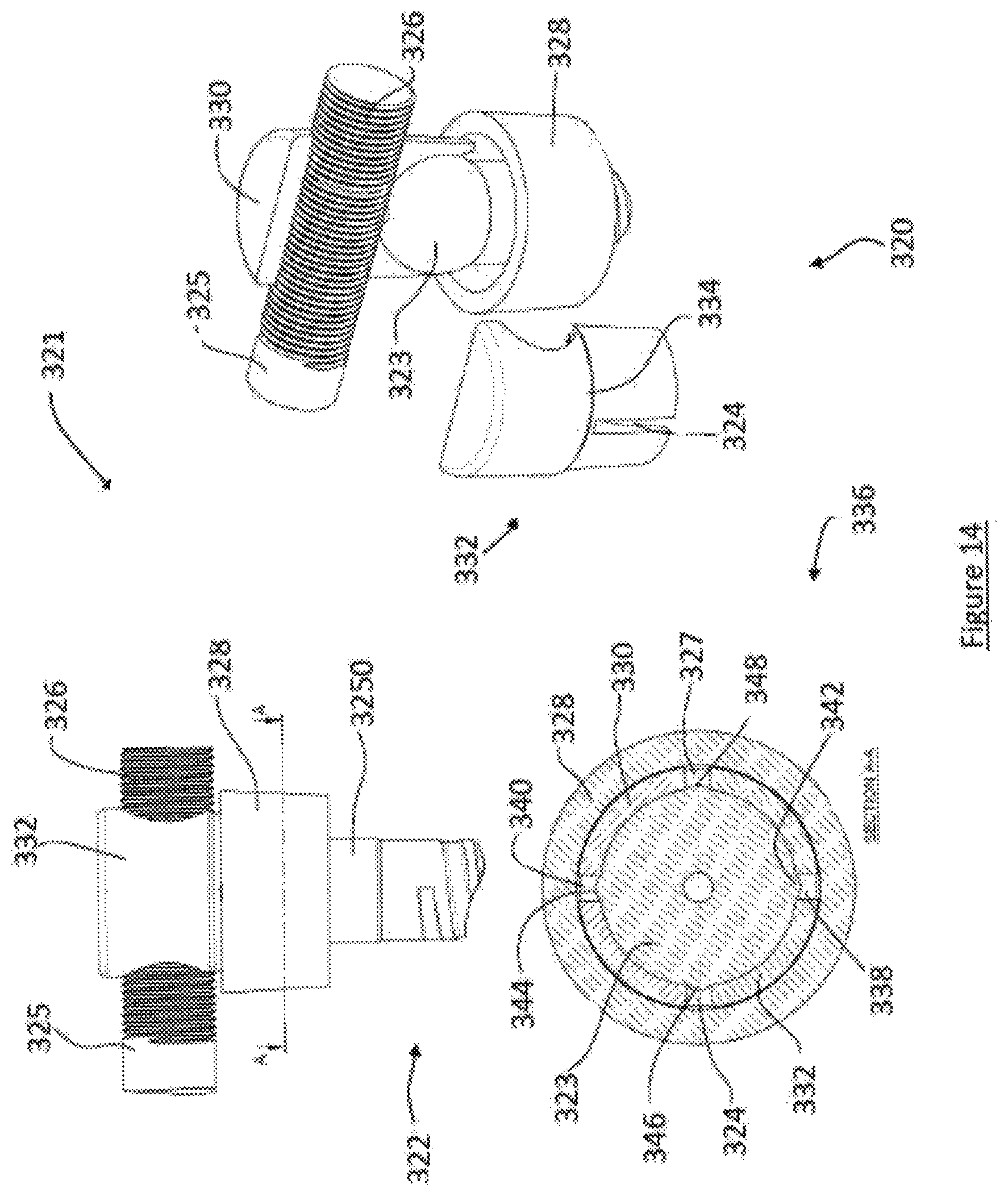 Patent US12599413 Figure 17 – Composite material spinal implant