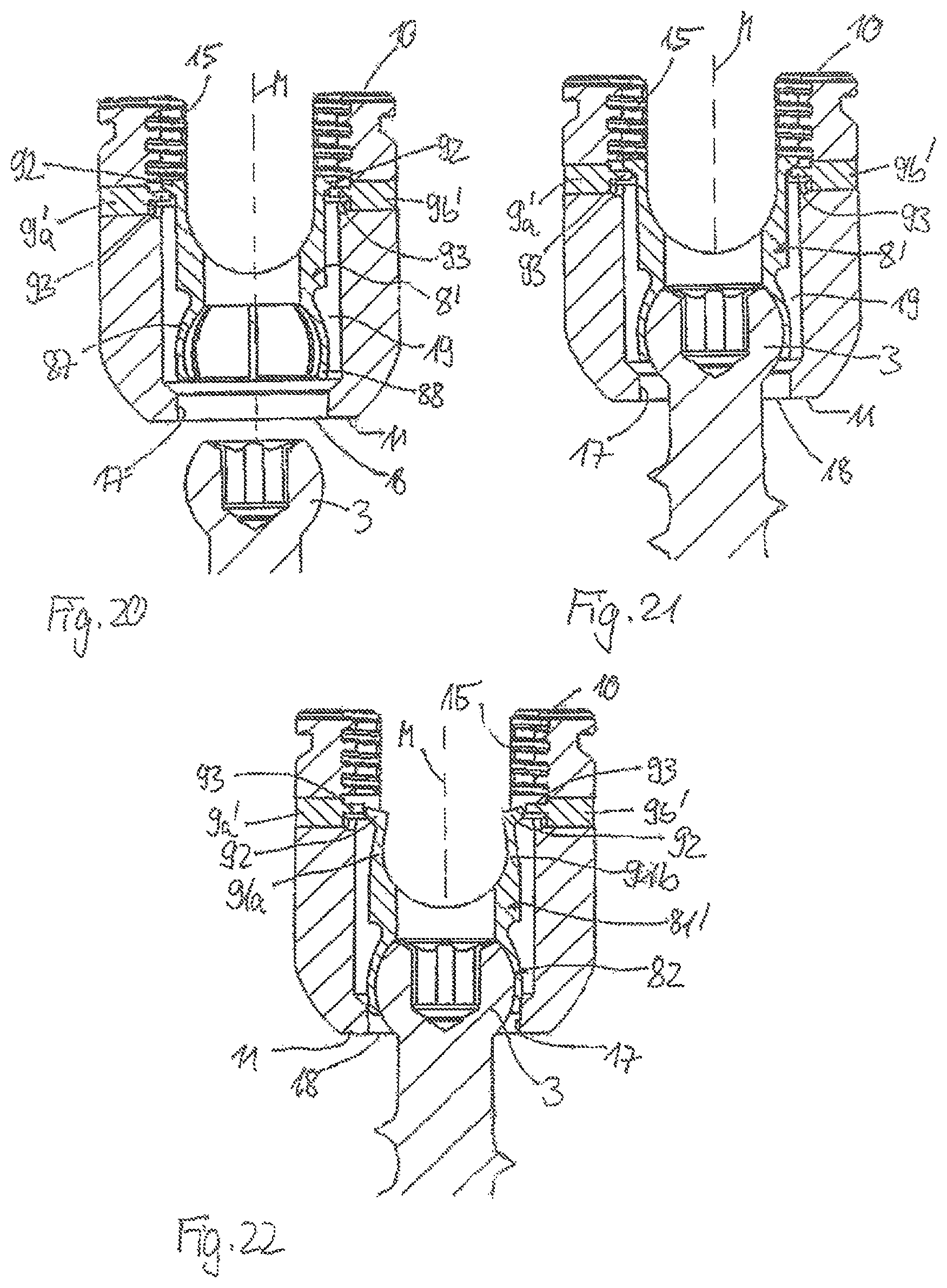 Patent US12599414 Figure 7 – Receiving part for receiving a rod for coupling the rod to a bone anchoring element and a bone anchoring device with such a receiving part