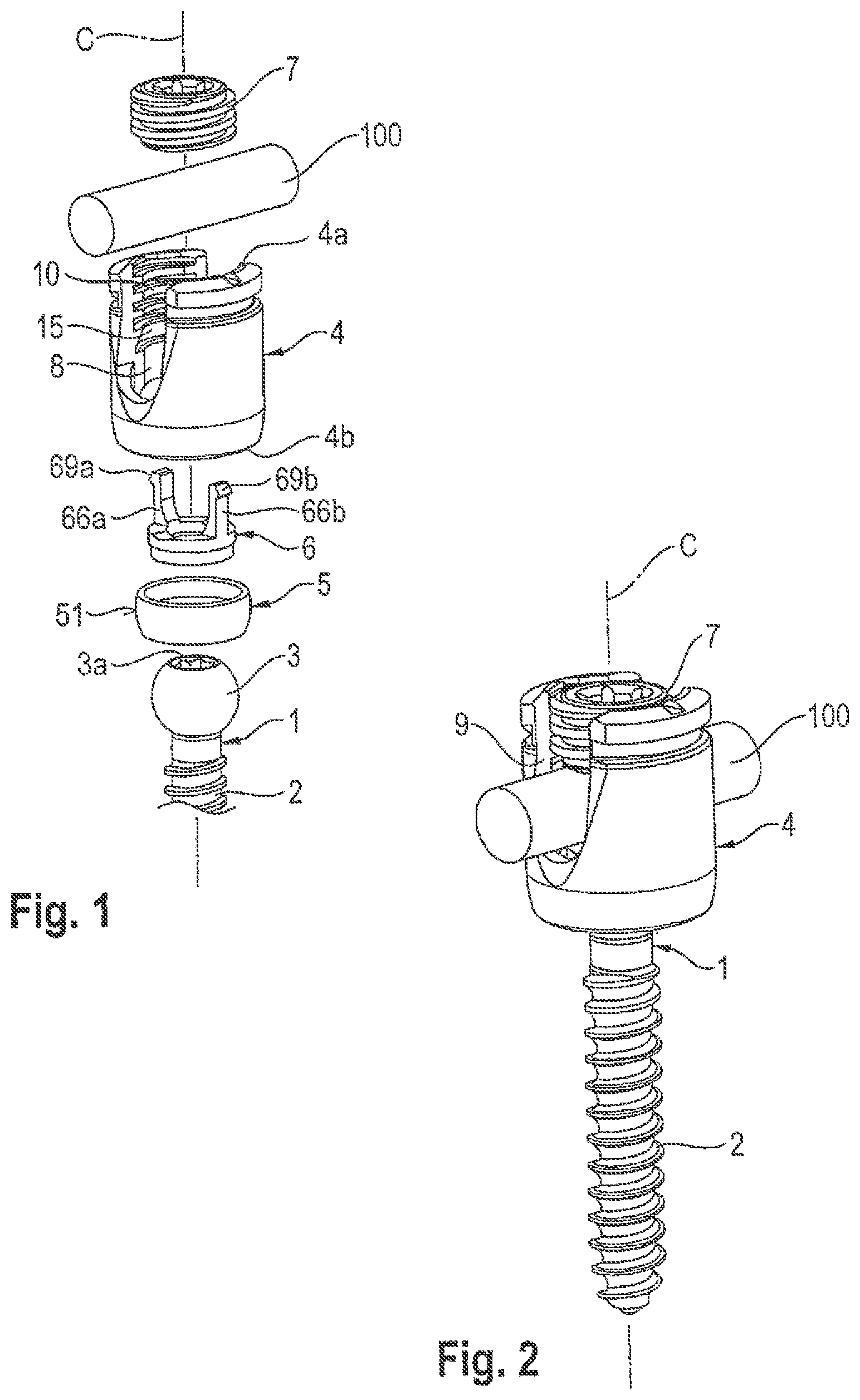 Patent US12599415 Figure 1 – Polyaxial bone anchoring device