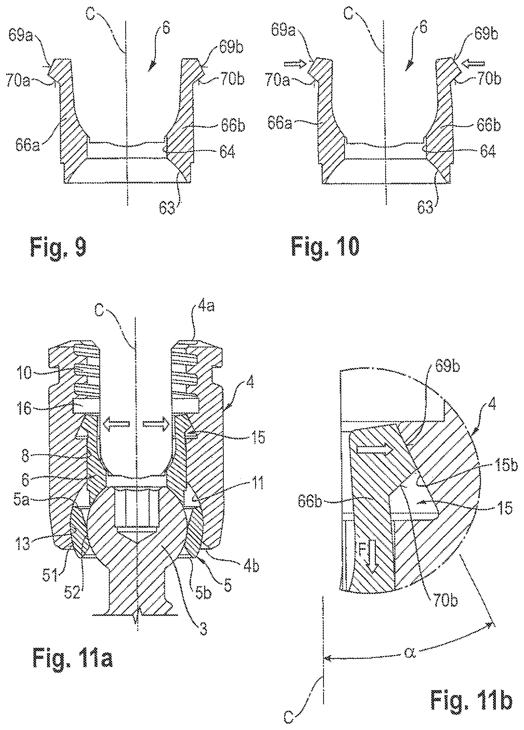 Patent US12599415 Figure 3 – Polyaxial bone anchoring device