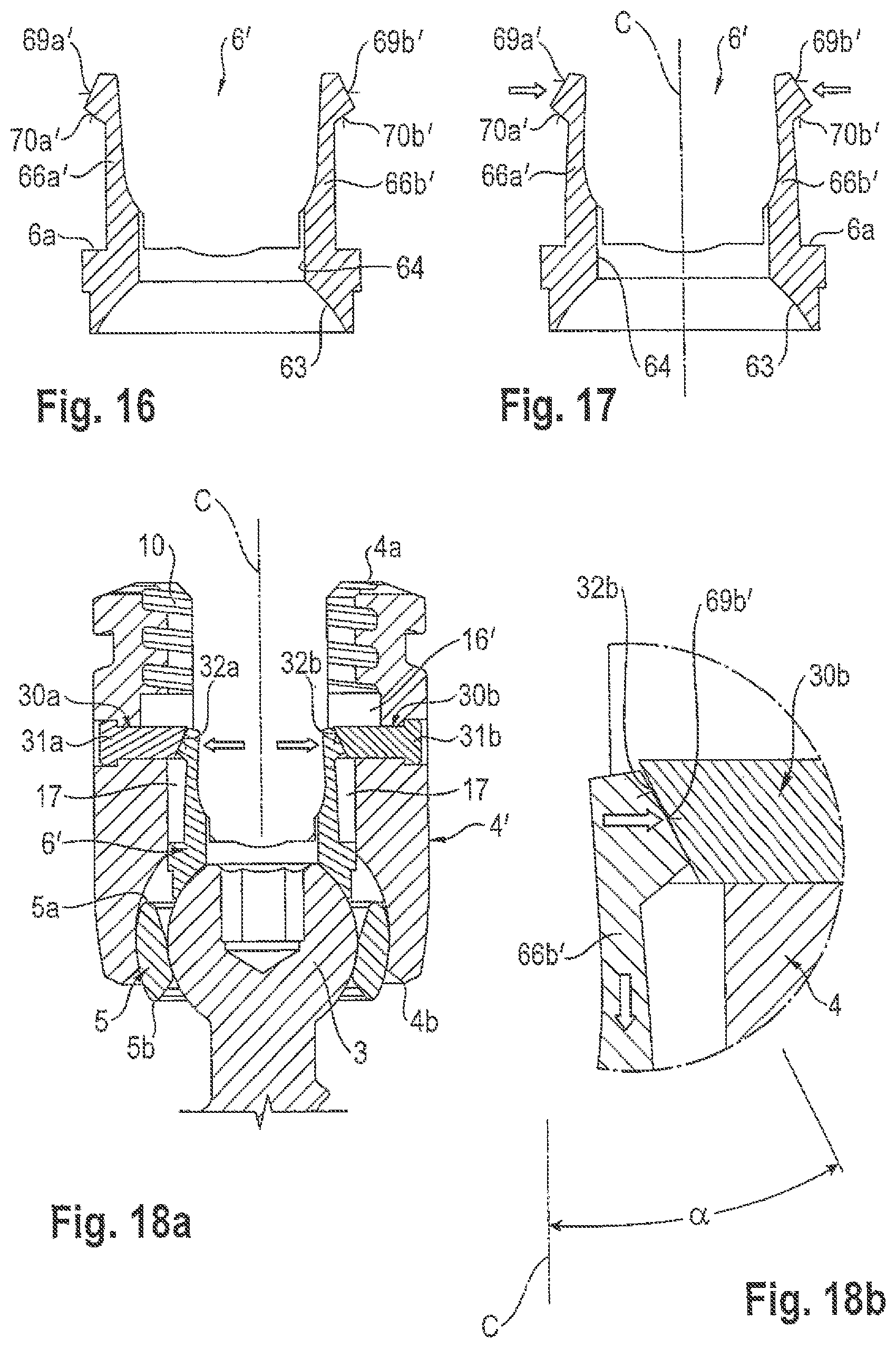 Patent US12599415 Figure 5 – Polyaxial bone anchoring device