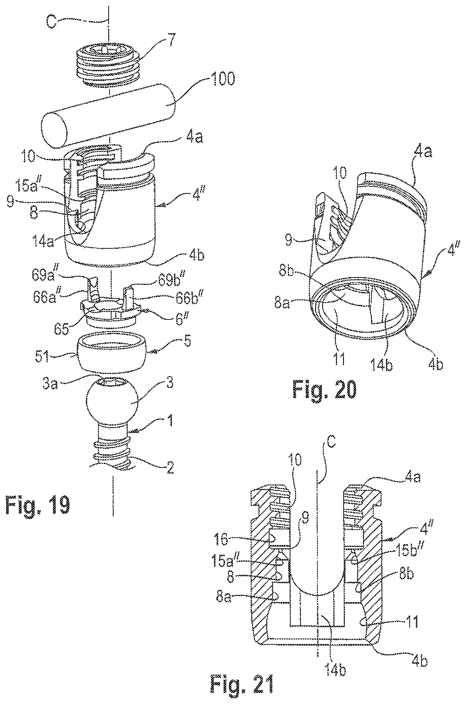 Patent US12599415 Figure 6 – Polyaxial bone anchoring device
