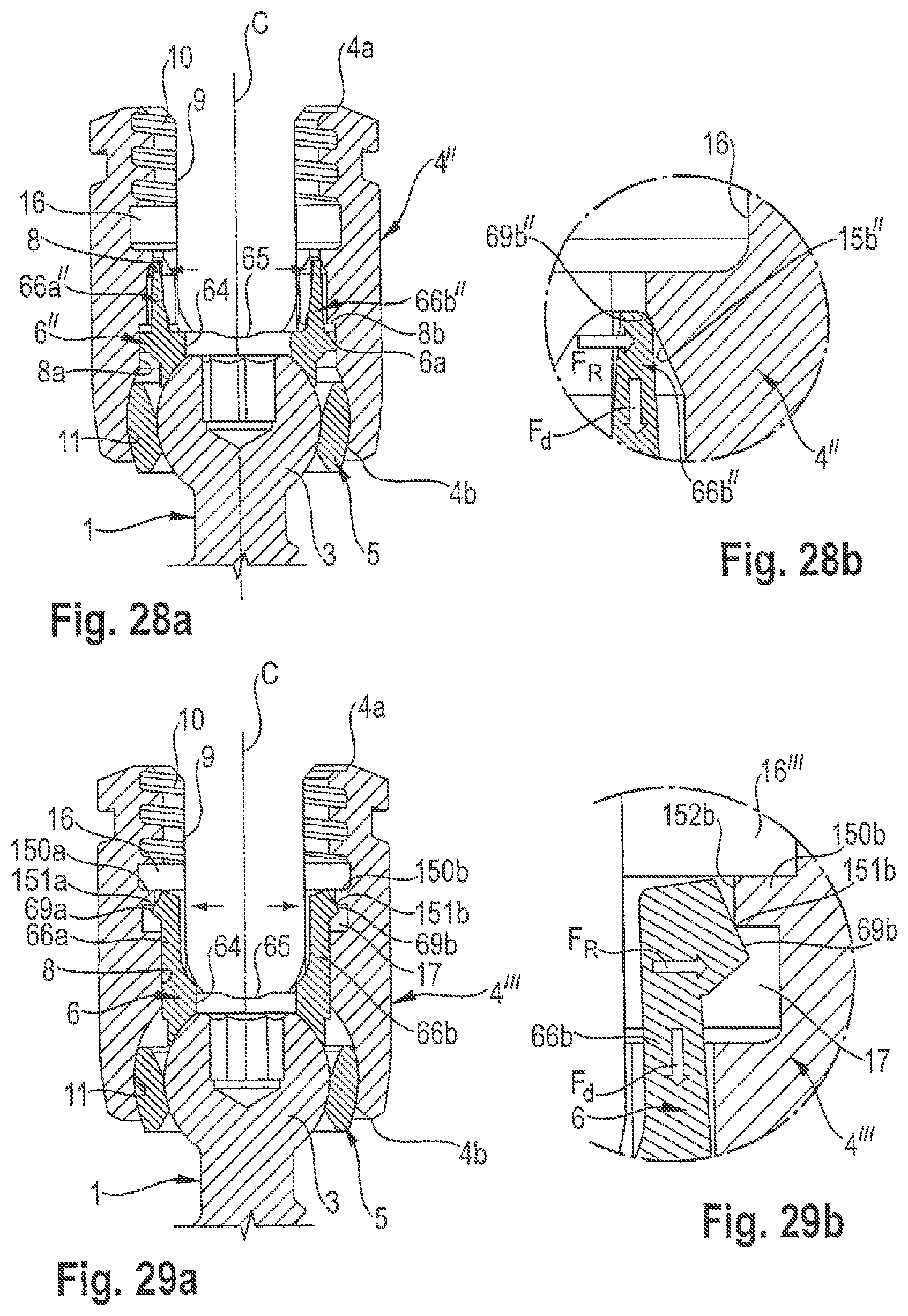 Patent US12599415 Figure 9 – Polyaxial bone anchoring device