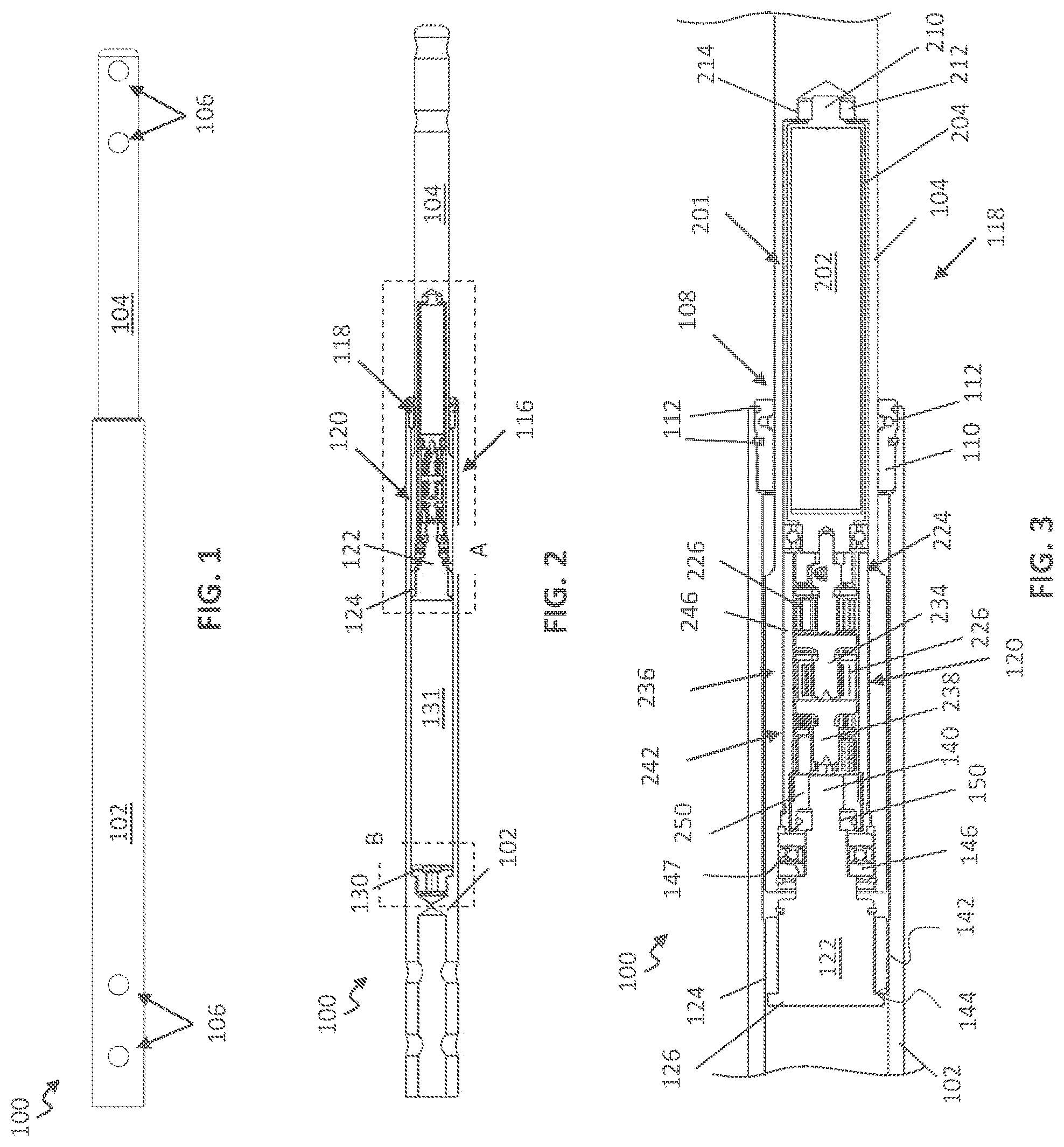 Patent US12599416 — Adjustable implant — Figure 1
