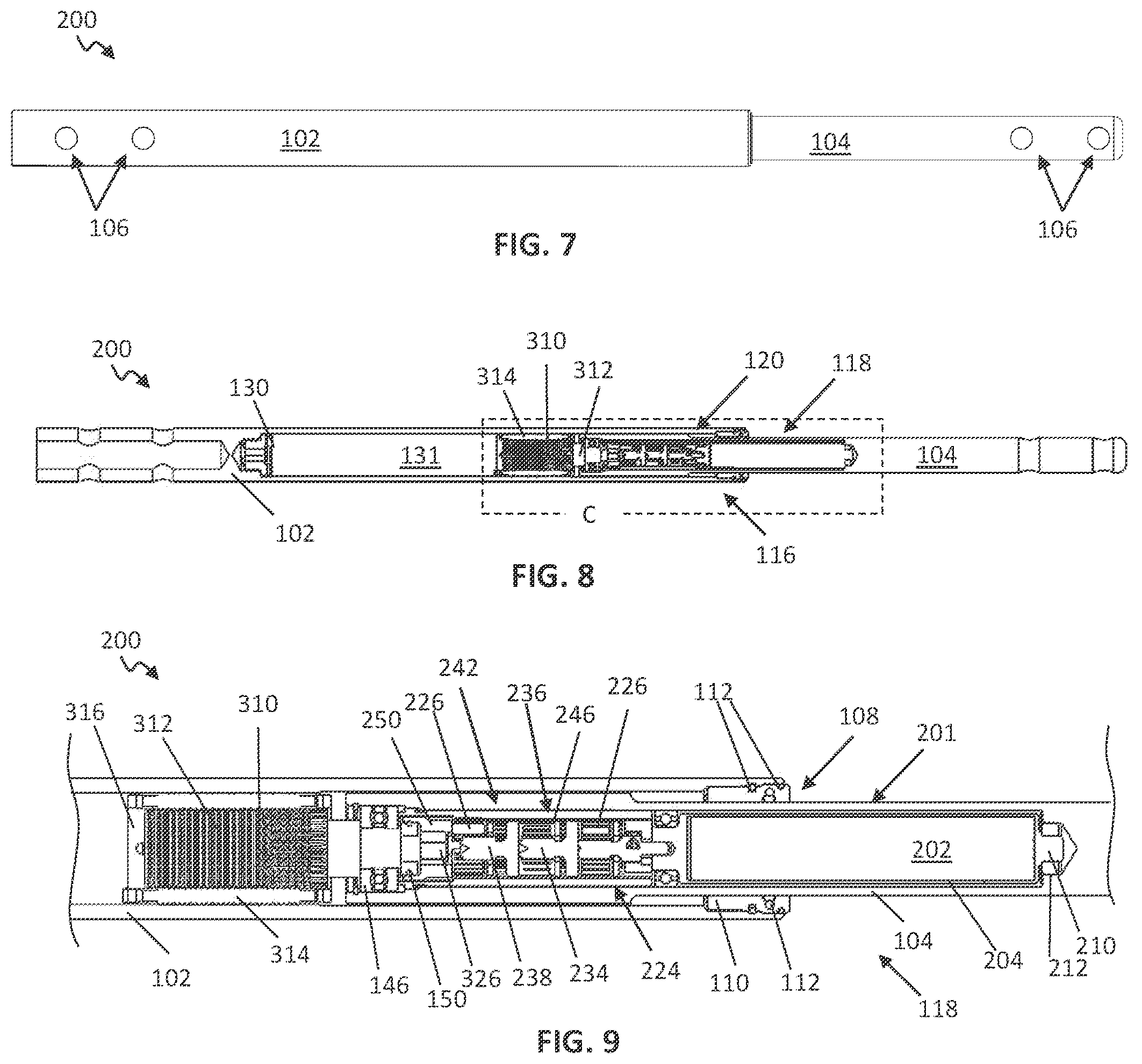 Patent US12599416 Figure 3 – Adjustable implant