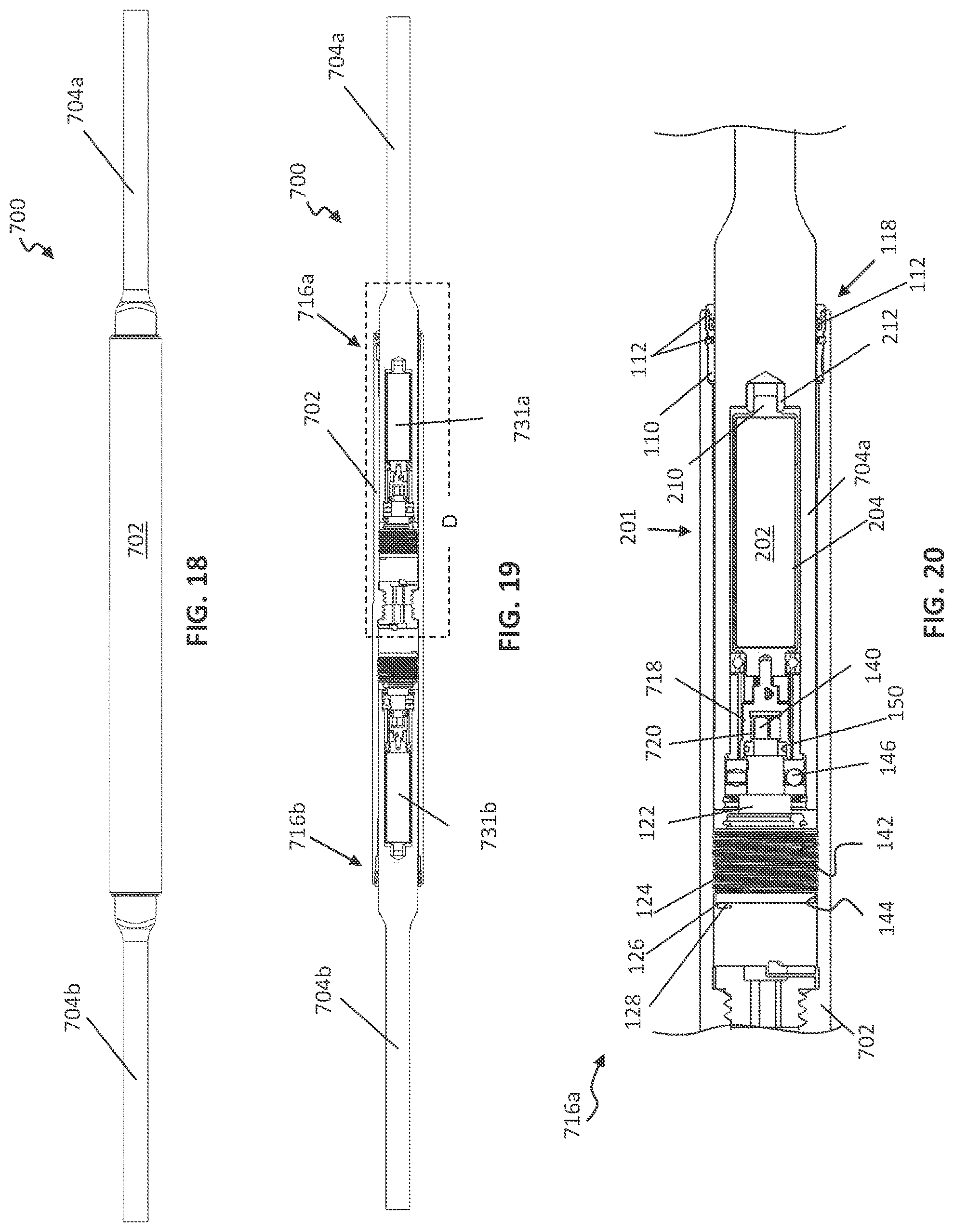 Patent US12599416 Figure 6 – Adjustable implant