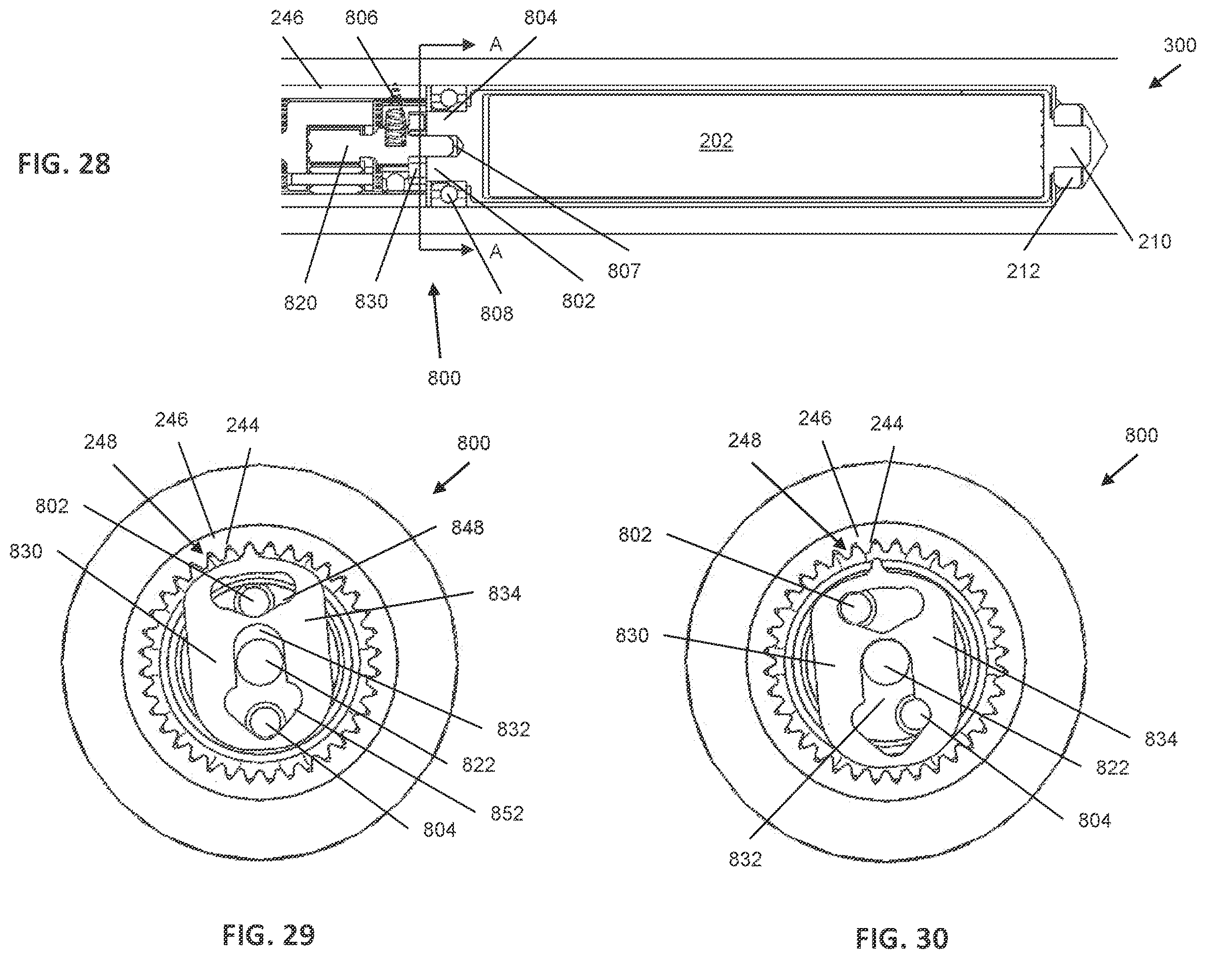 Patent US12599416 Figure 9 – Adjustable implant
