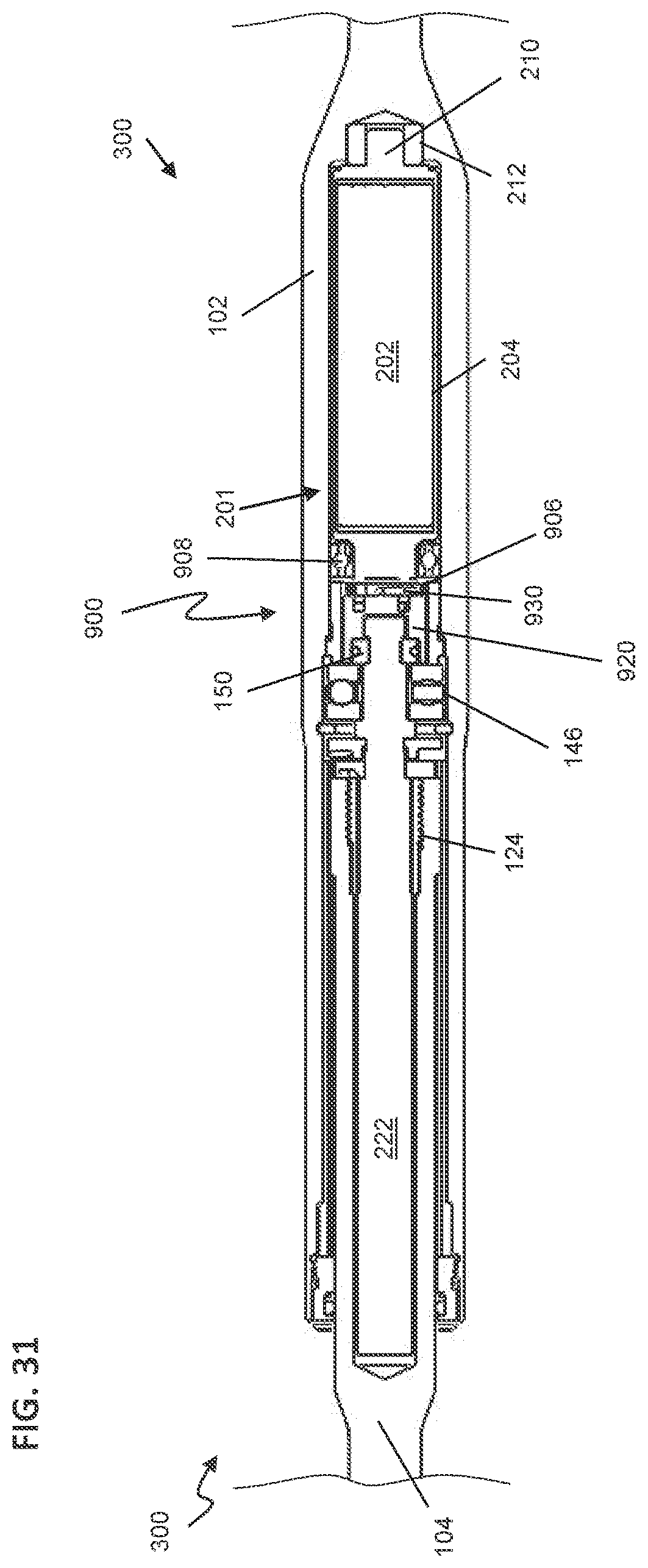 Patent US12599416 Figure 10 – Adjustable implant
