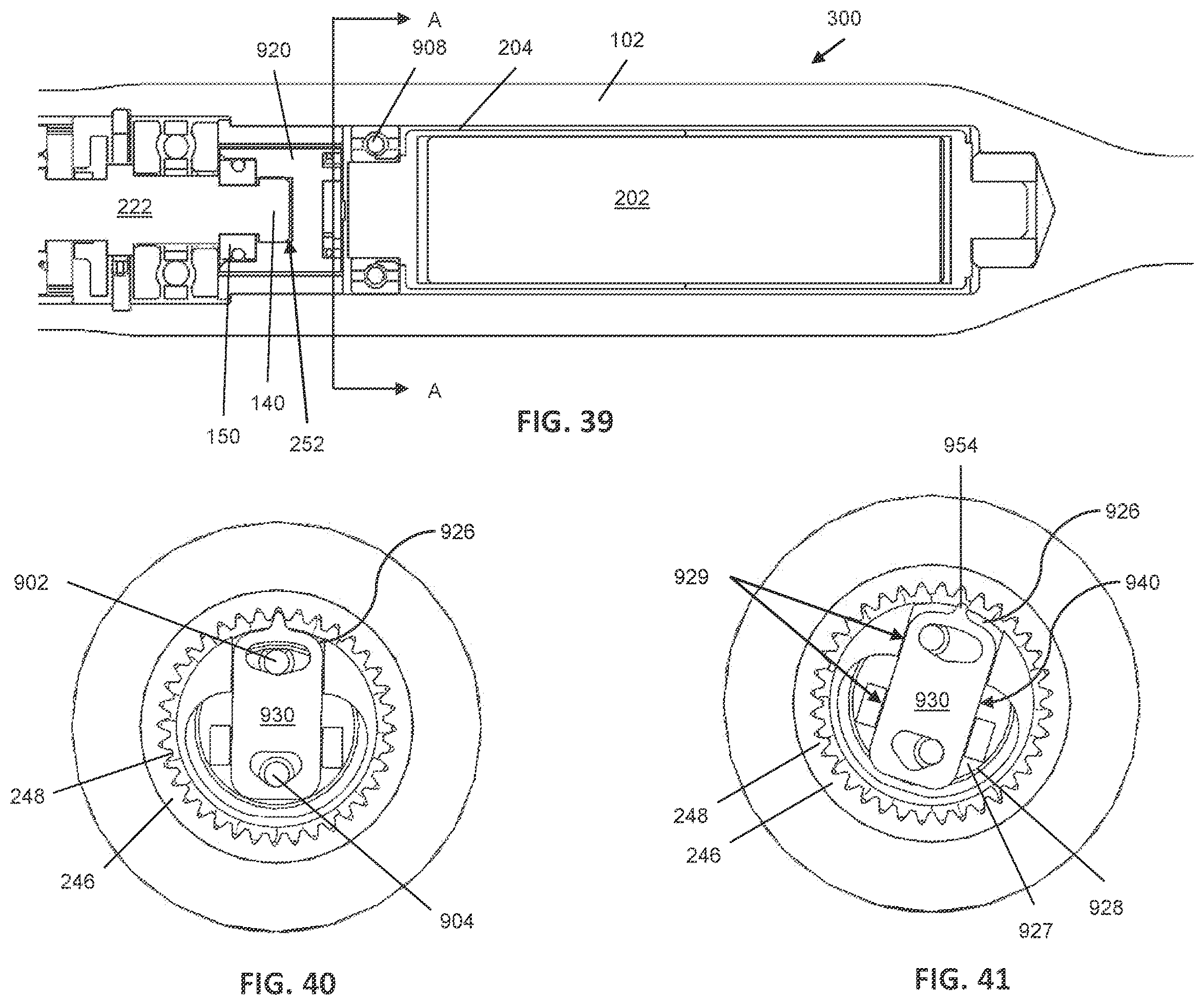 Patent US12599416 Figure 13 – Adjustable implant