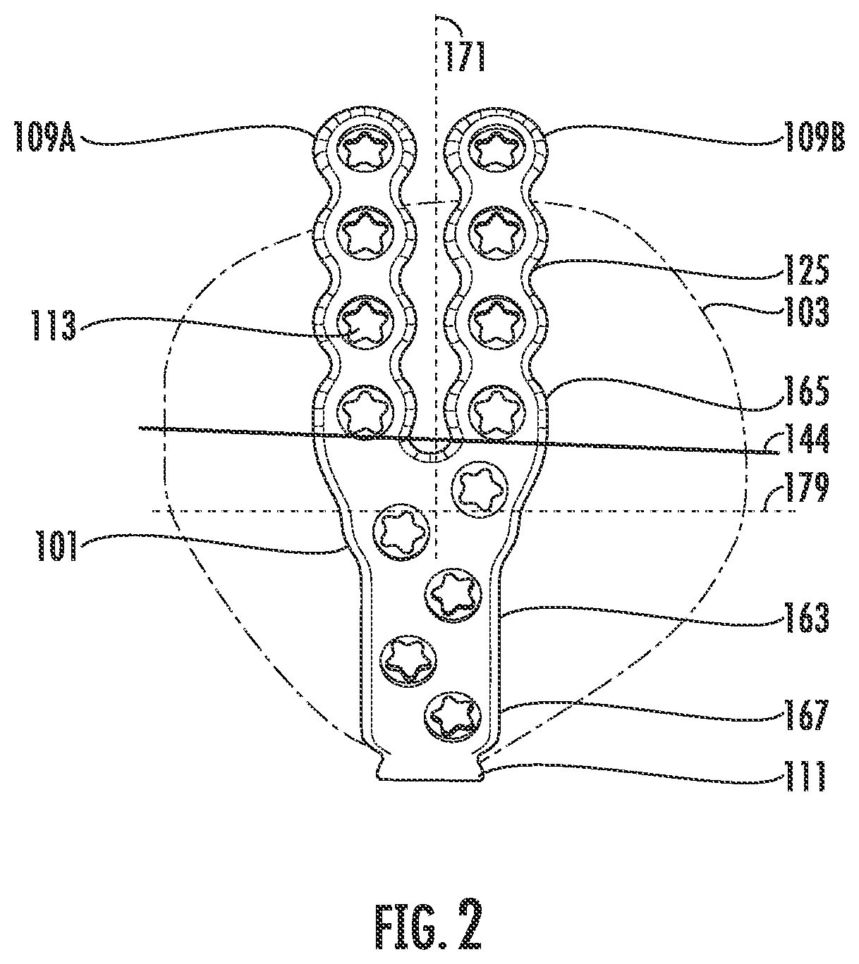 Patent US12599417 Figure 2 – Patella bone plate systems