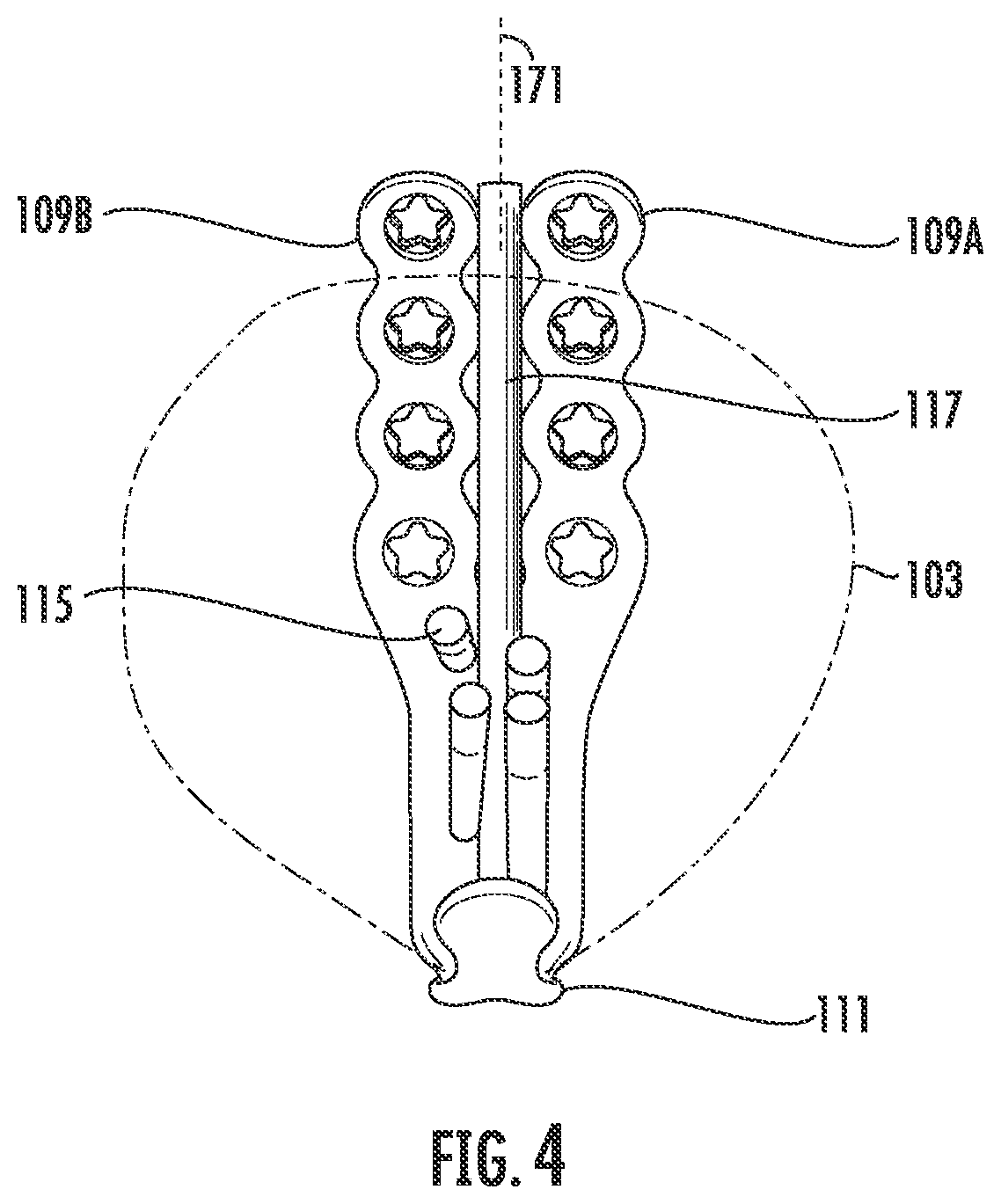 Patent US12599417 Figure 4 – Patella bone plate systems