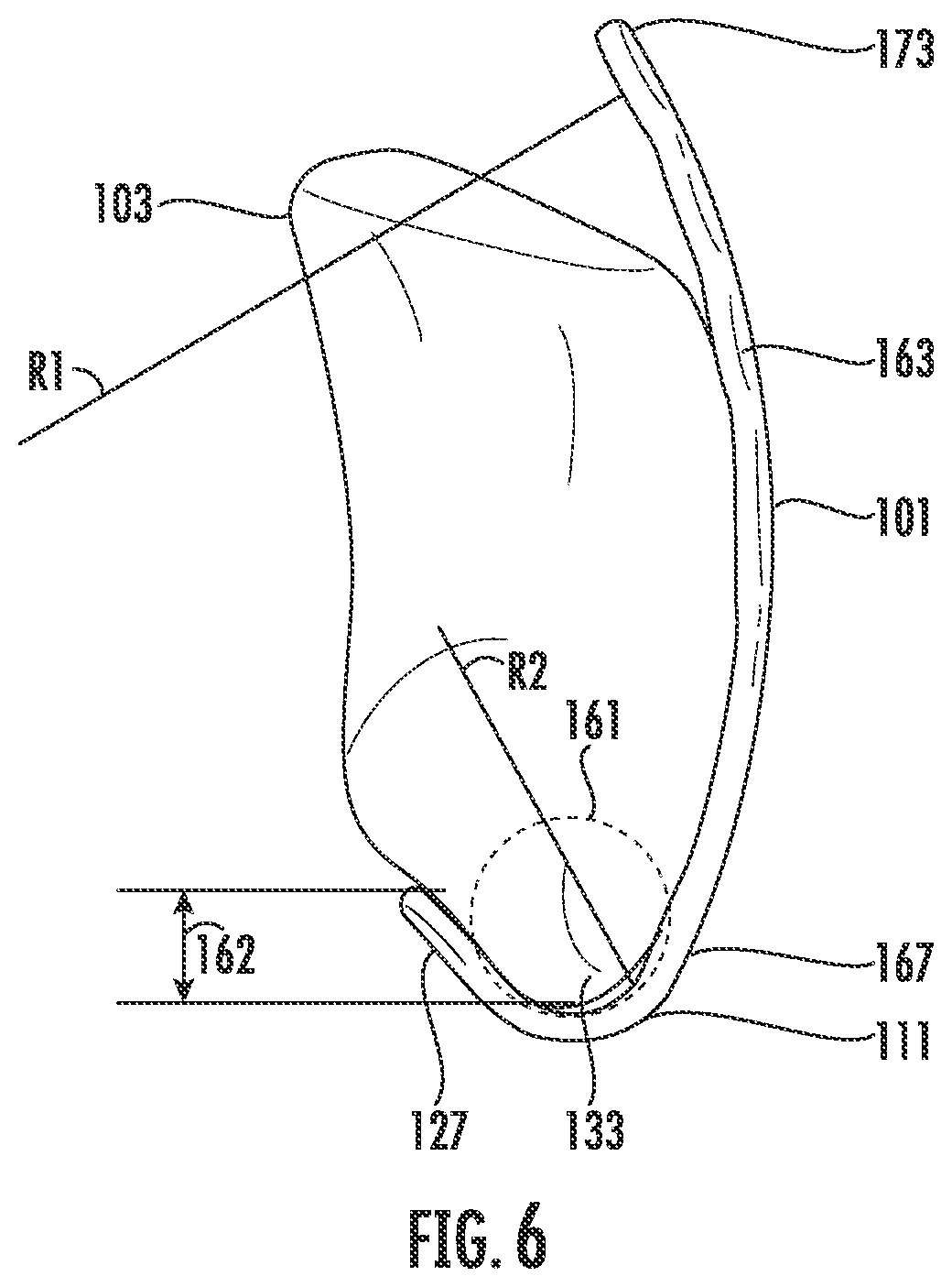 Patent US12599417 Figure 6 – Patella bone plate systems