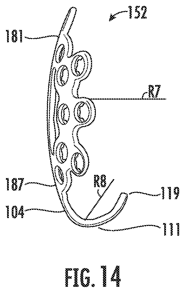 Patent US12599417 Figure 11 – Patella bone plate systems