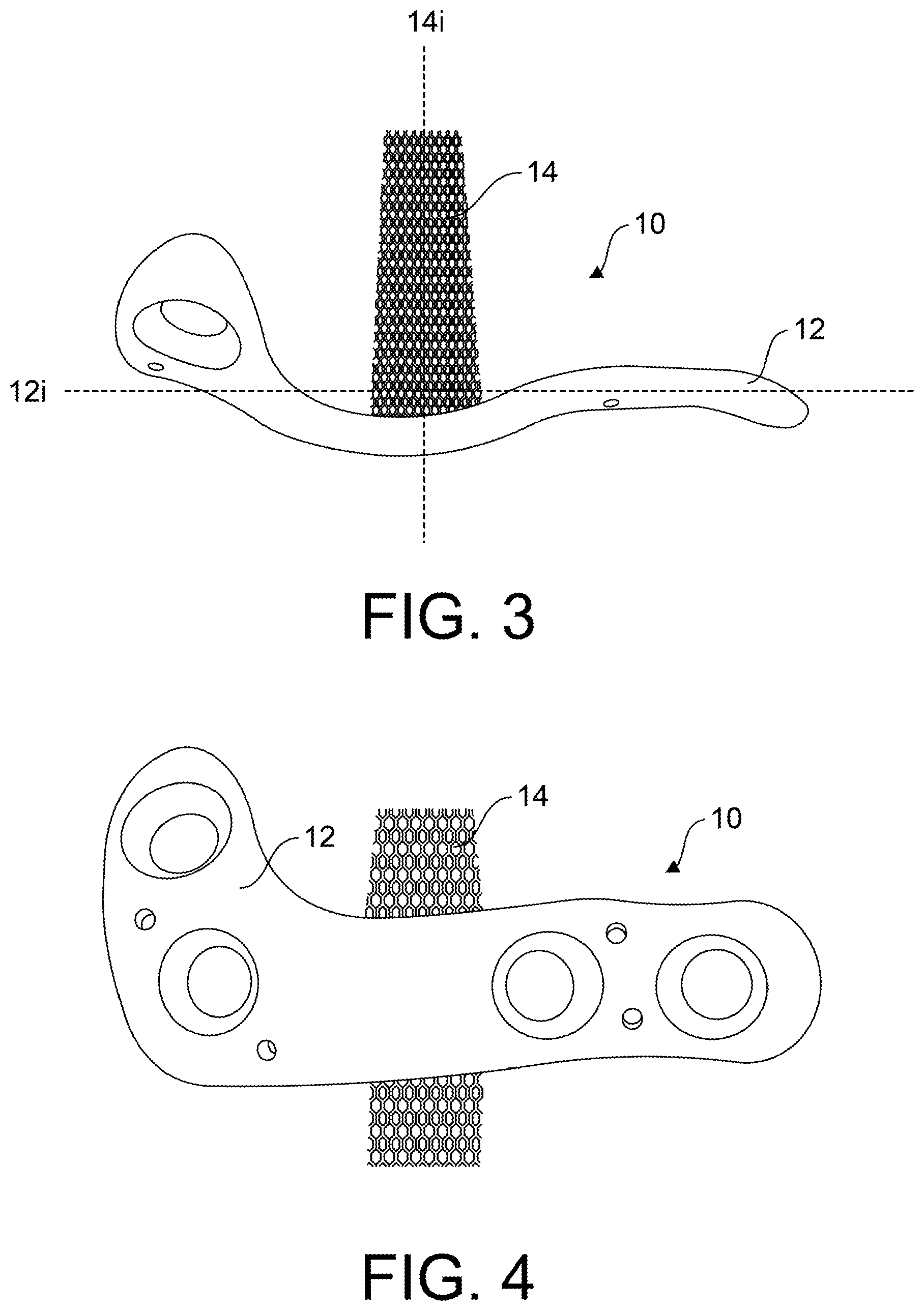 Patent US12599418 Figure 2 – Bone fixation devices