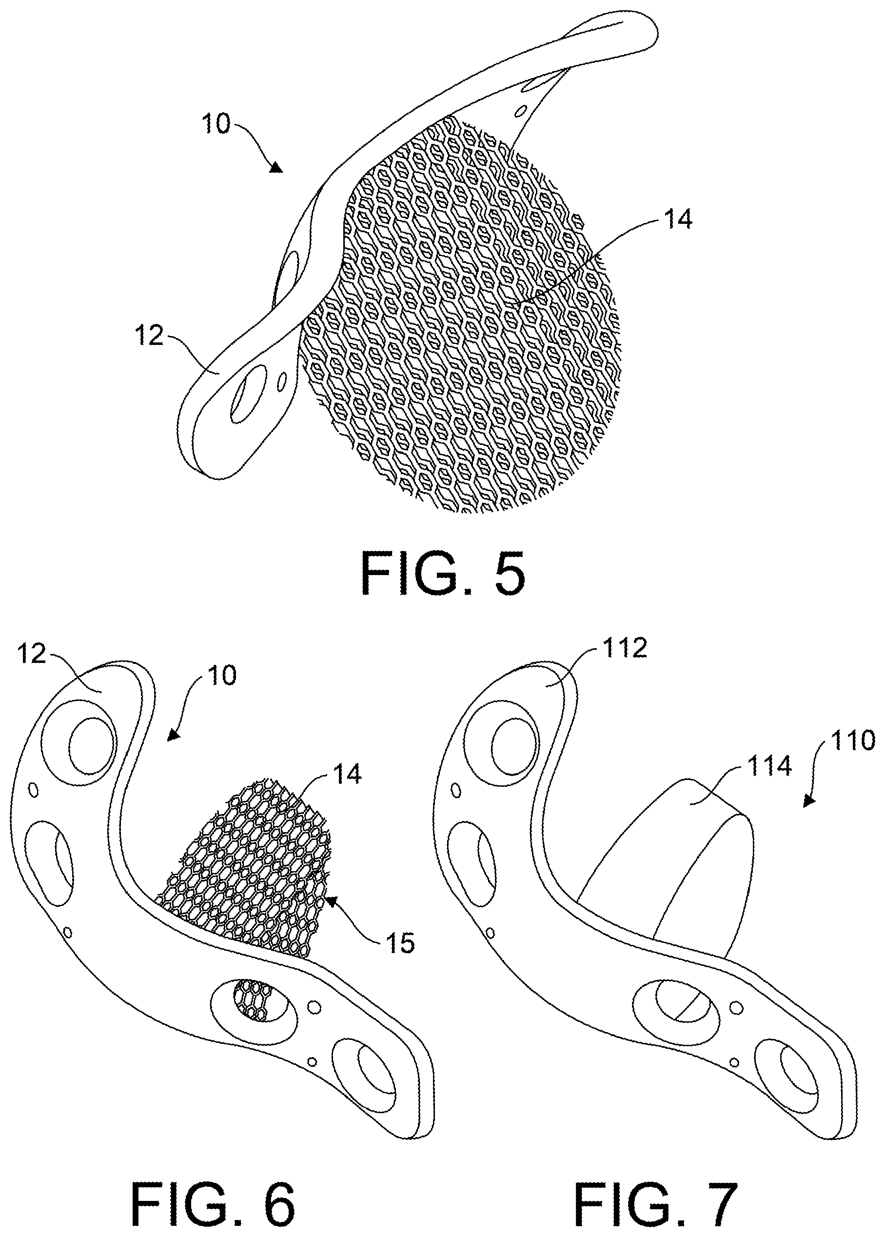 Patent US12599418 Figure 3 – Bone fixation devices
