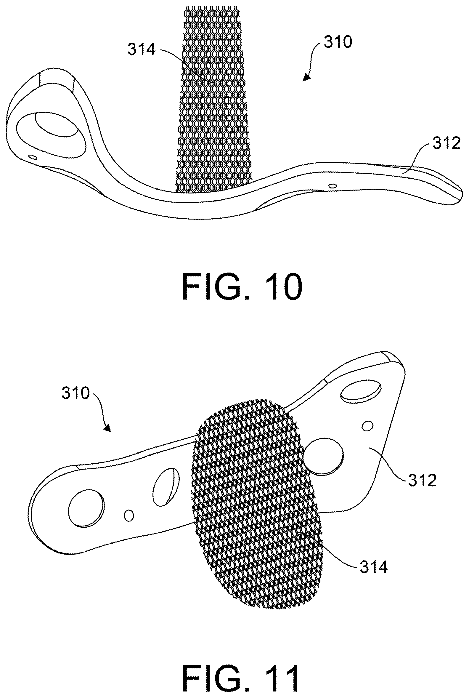 Patent US12599418 Figure 5 – Bone fixation devices