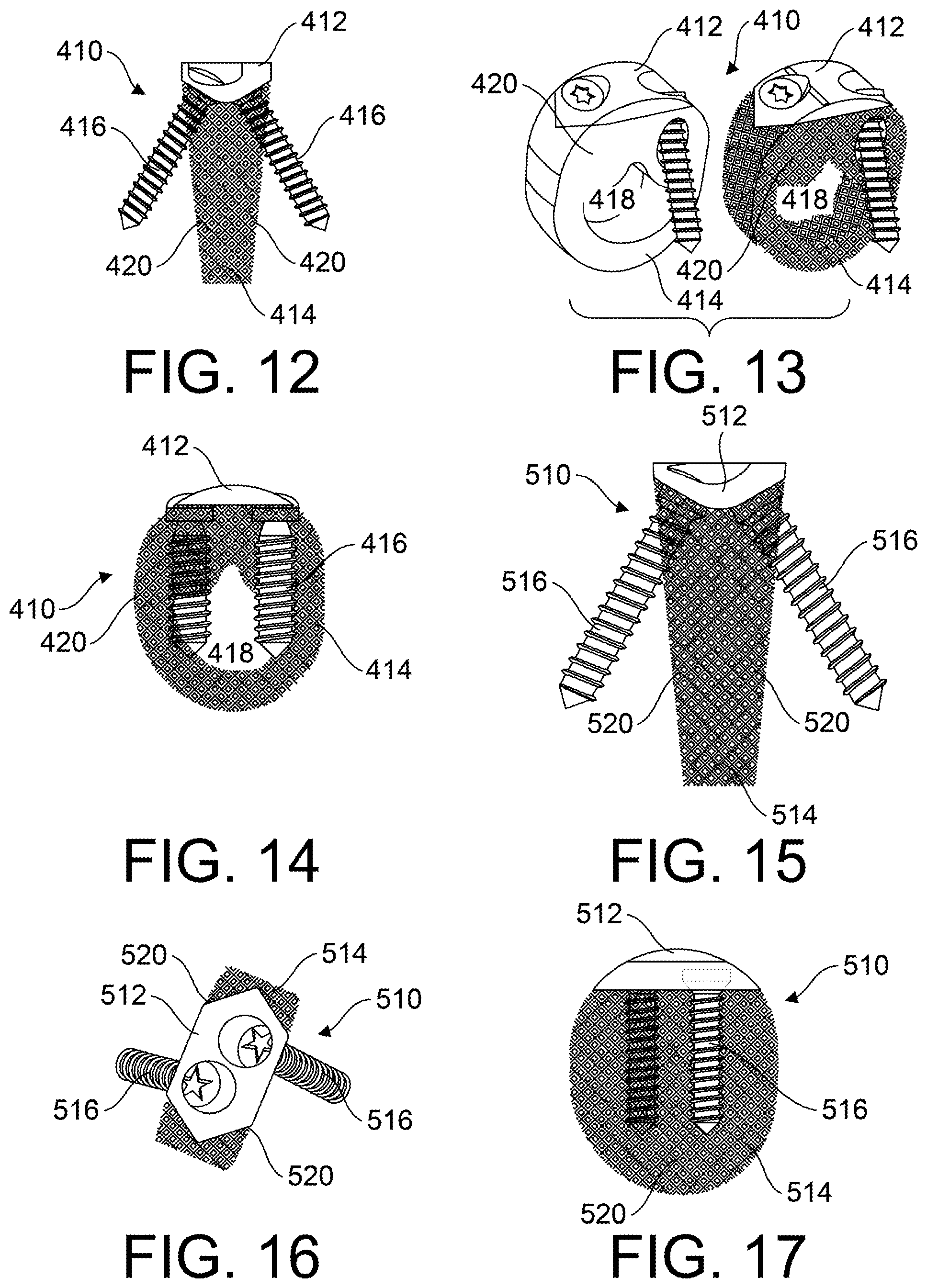 Patent US12599418 Figure 6 – Bone fixation devices