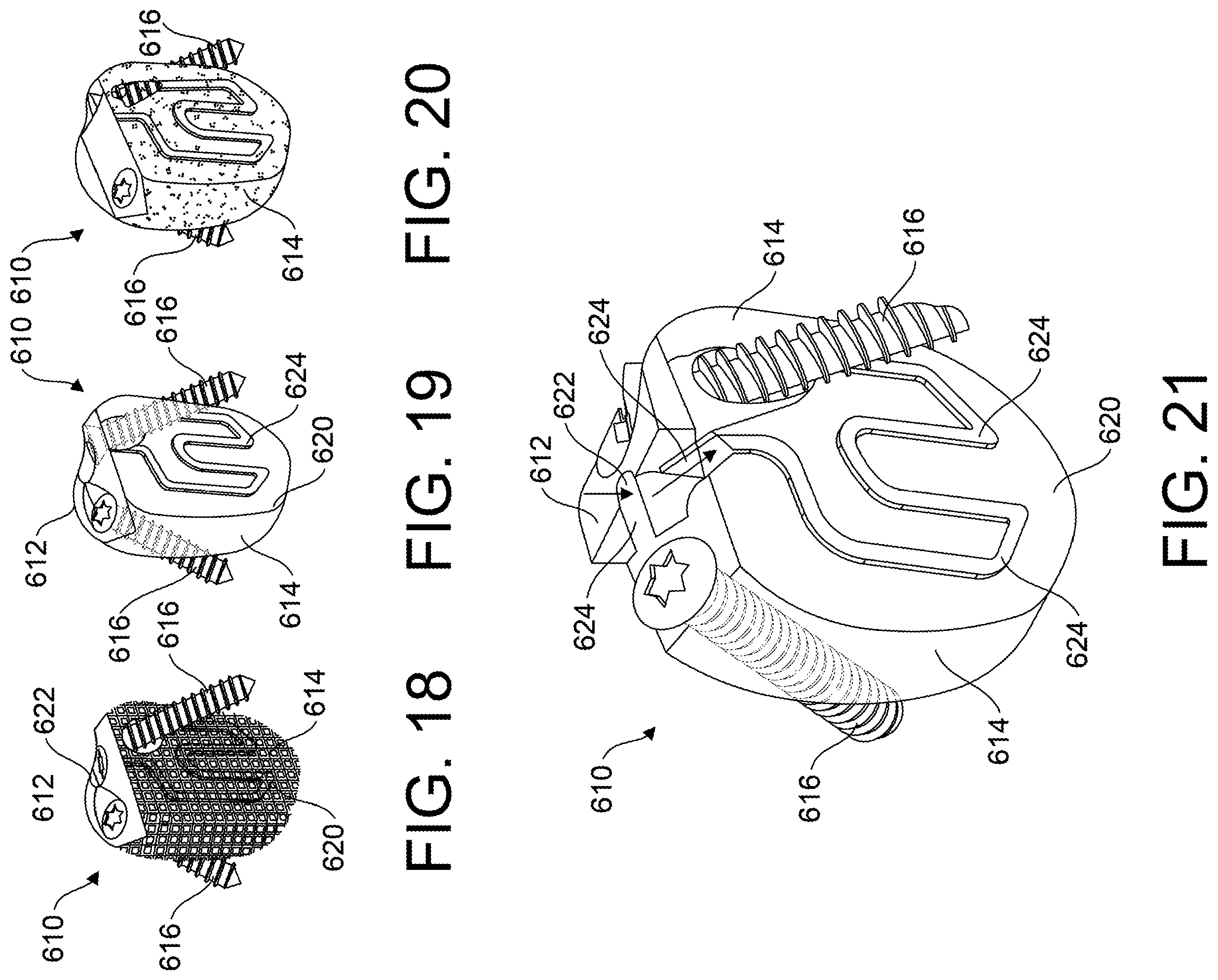 Patent US12599418 Figure 7 – Bone fixation devices