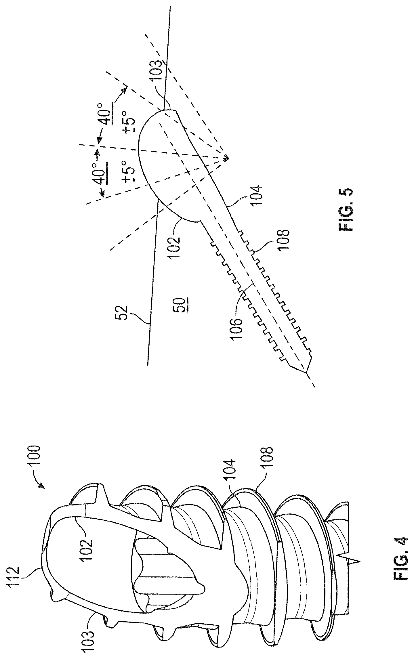 Patent US12599419 Figure 2 – Beveled screw
