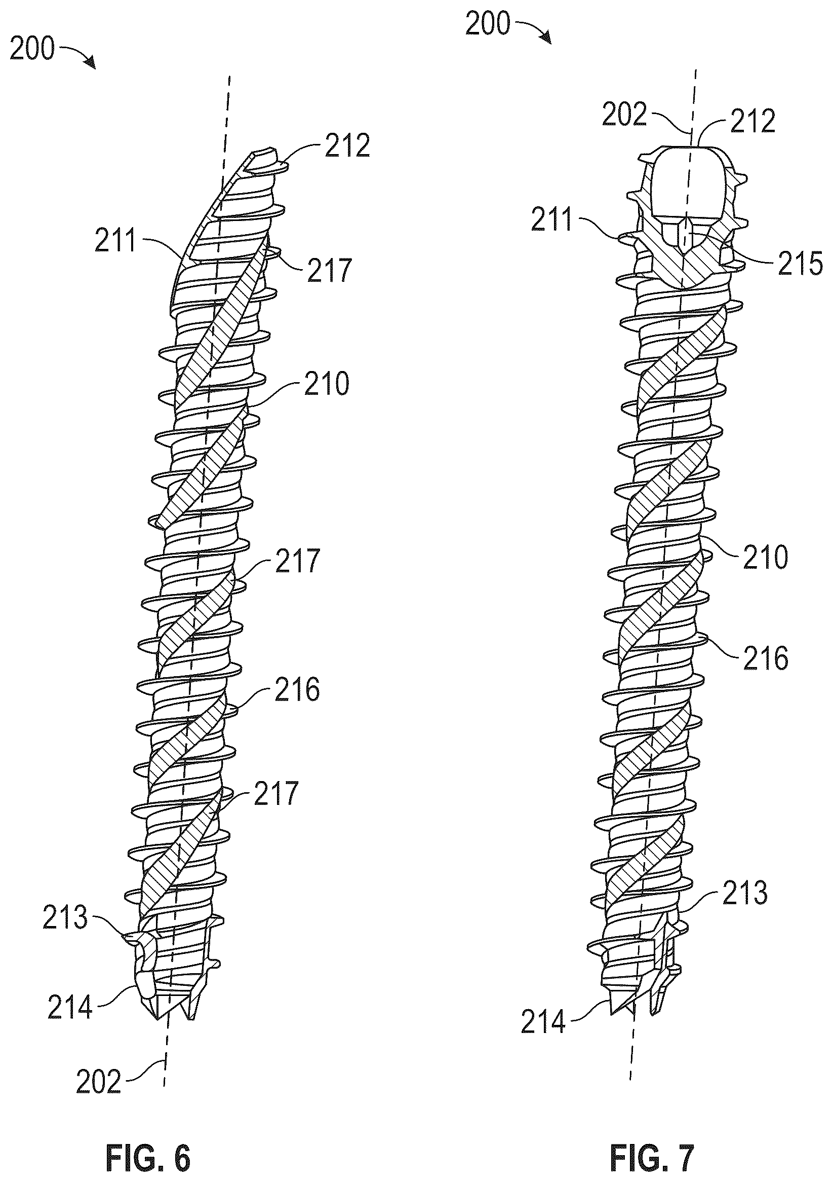 Patent US12599419 Figure 3 – Beveled screw