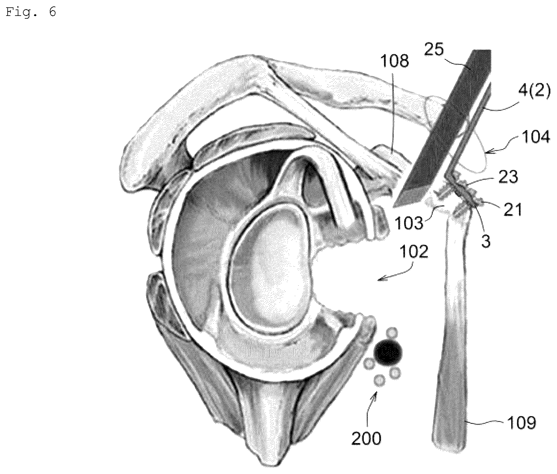 Patent US12599420 Figure 6 – Surgical instrument, medical tool set, and movement method