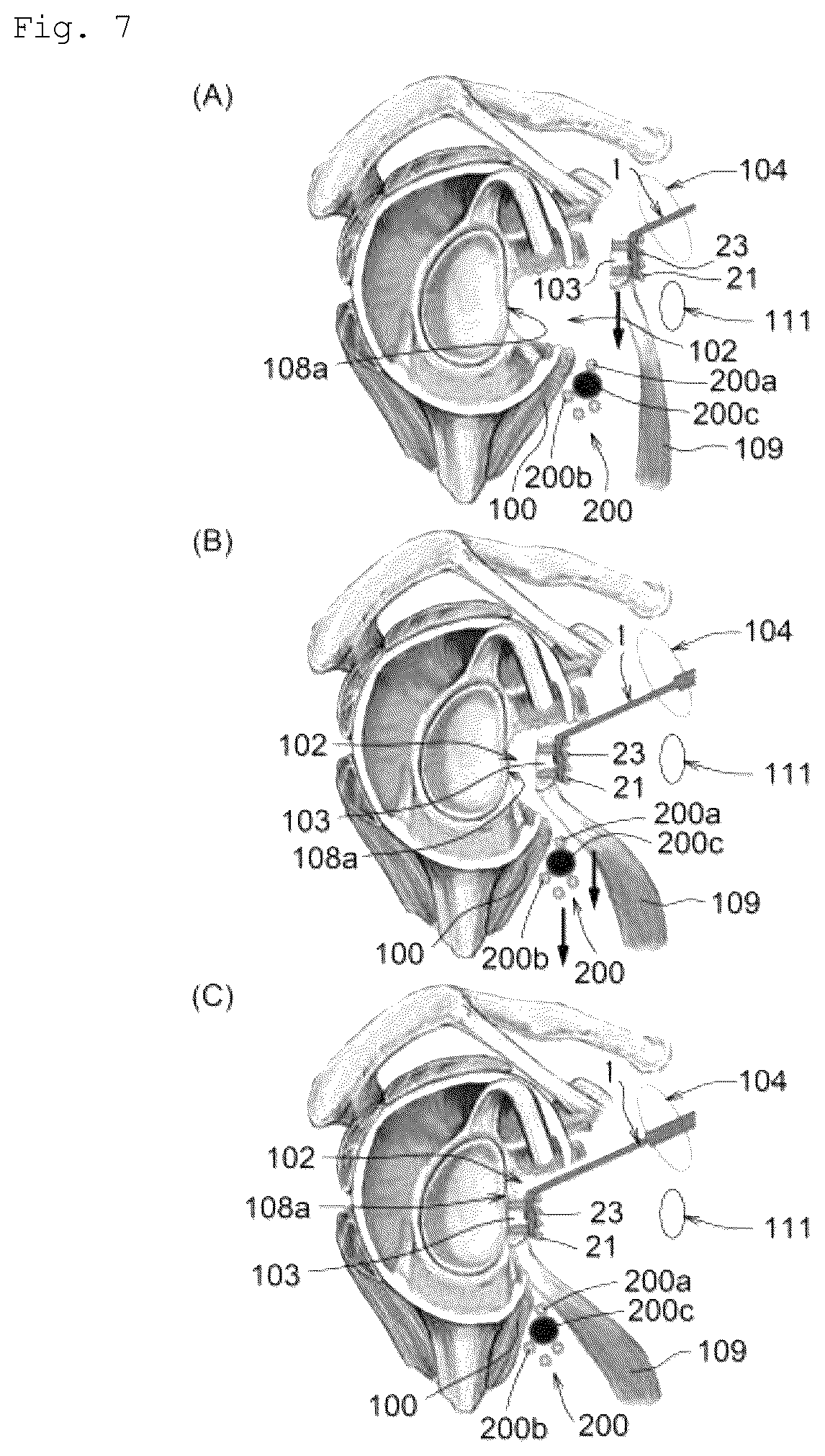 Patent US12599420 Figure 7 – Surgical instrument, medical tool set, and movement method