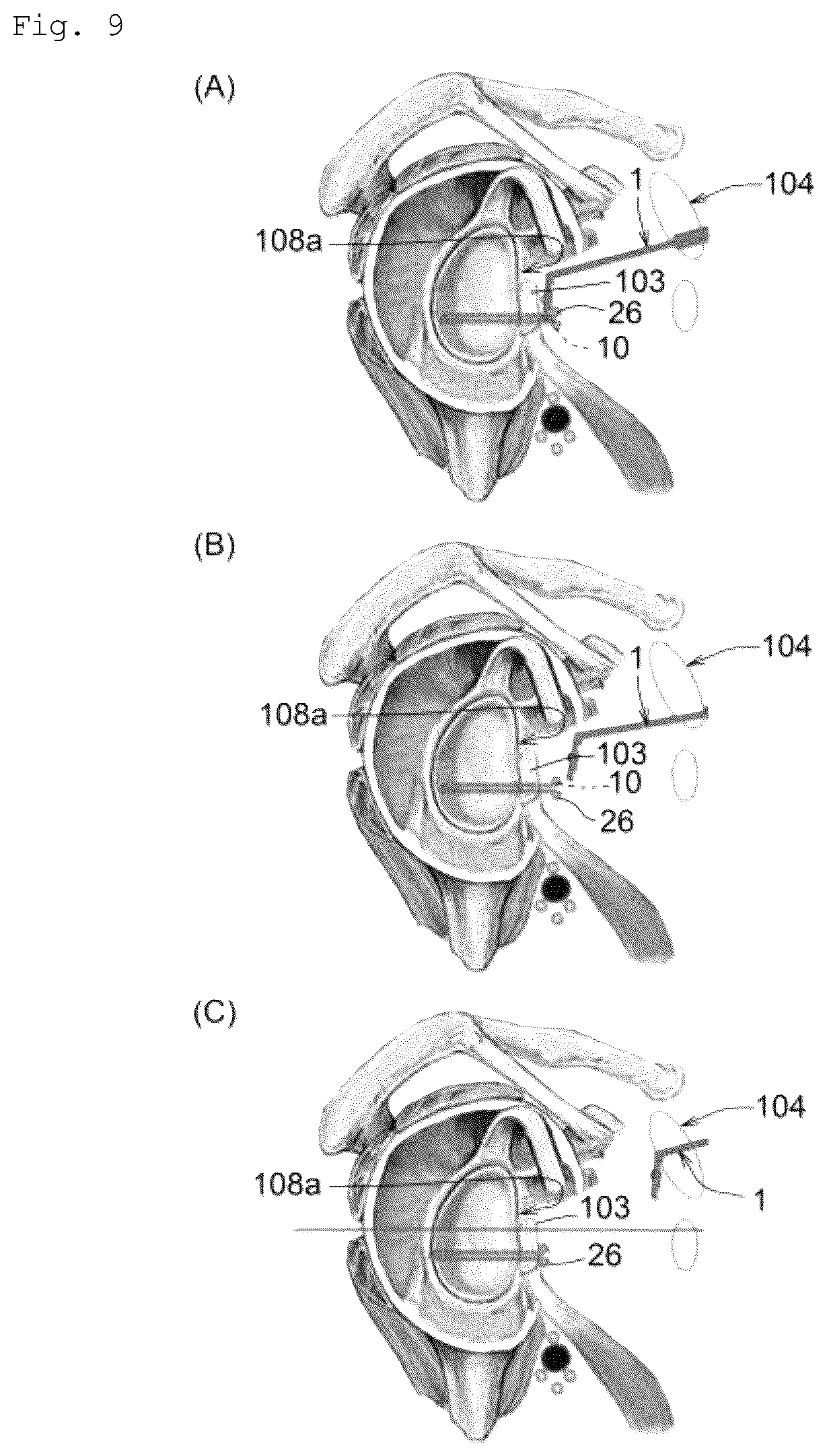 Patent US12599420 Figure 9 – Surgical instrument, medical tool set, and movement method