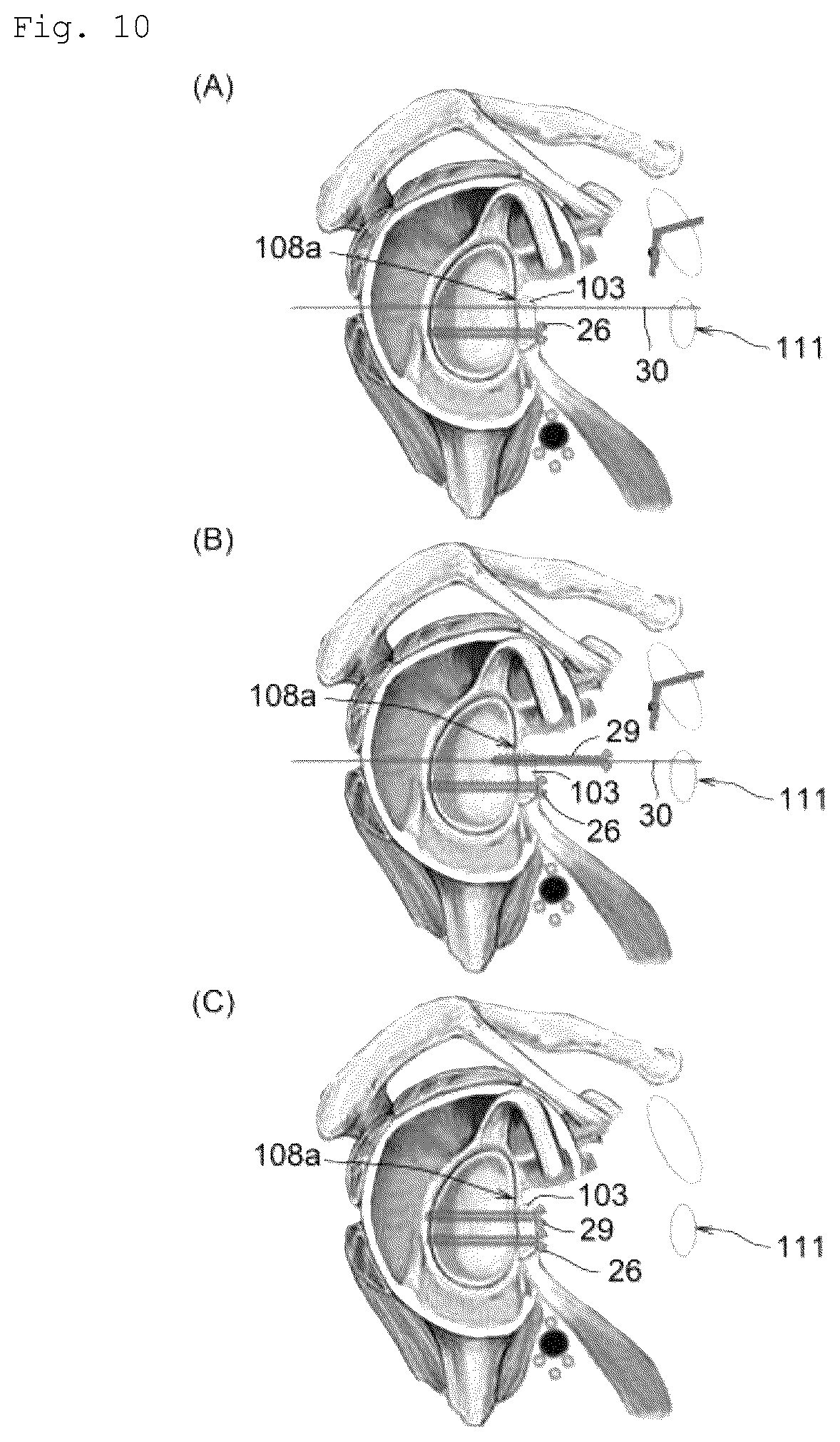 Patent US12599420 Figure 10 – Surgical instrument, medical tool set, and movement method